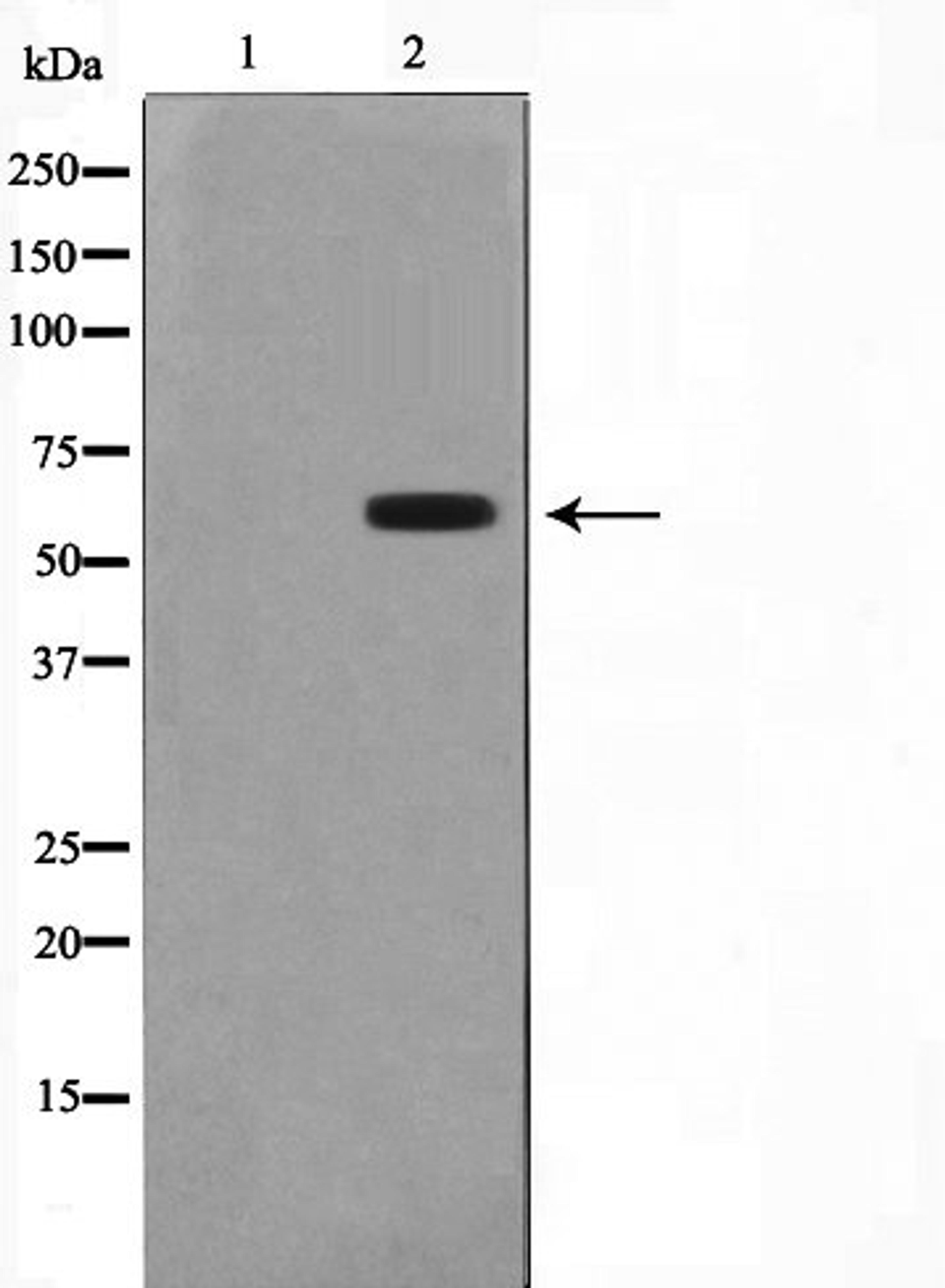 Western blot analysis of 293 cell lysate using 2C19 (Cytochrome P450) antibody