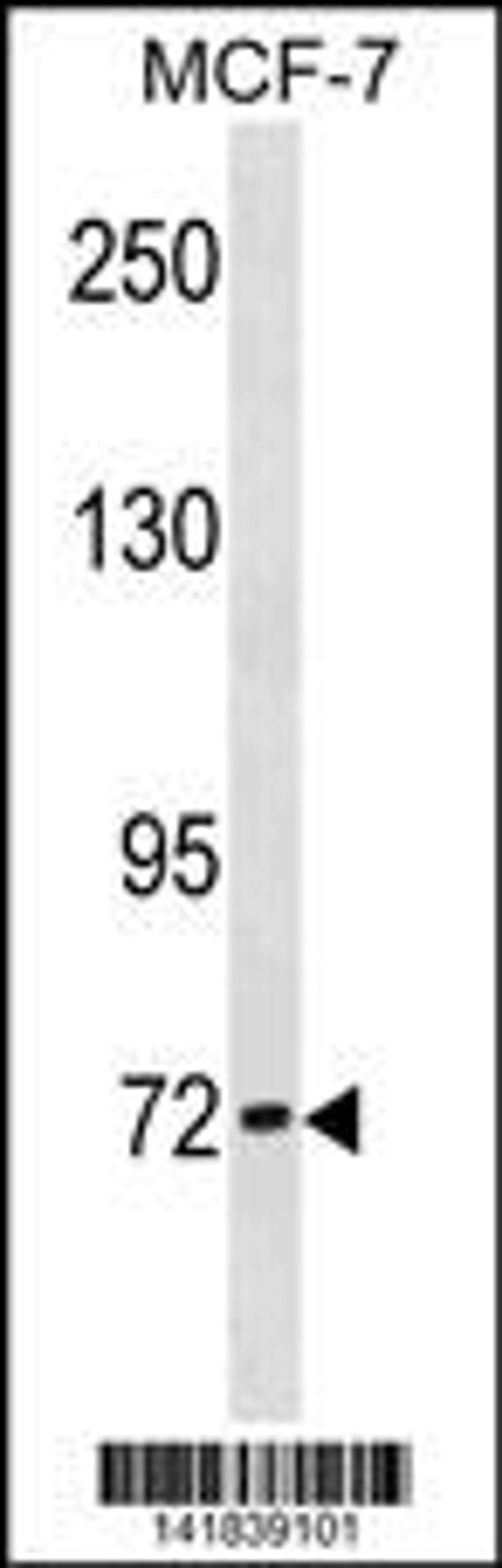 Western blot analysis in MCF-7 cell line lysates (35ug/lane).