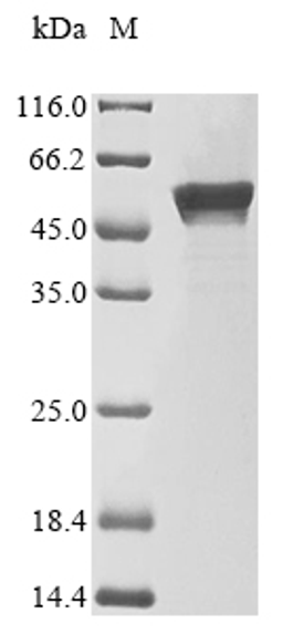 (Tris-Glycine gel) Discontinuous SDS-PAGE (reduced) with 5% enrichment gel and 15% separation gel.