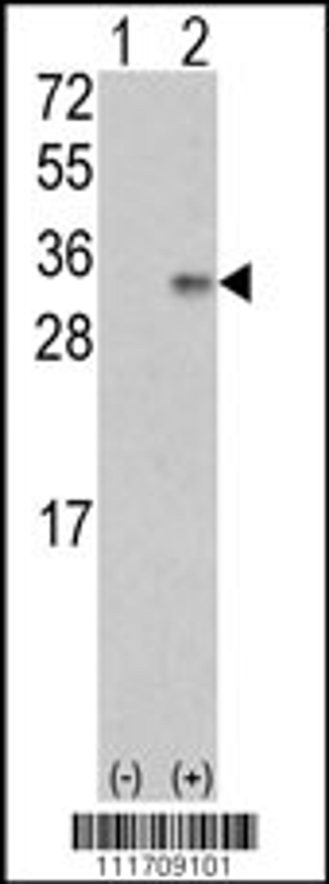 Western blot analysis of VEGF2 using rabbit polyclonal VEGF2 Antibody using 293 cell lysates (2 ug/lane) either nontransfected (Lane 1) or transiently transfected with the VEGF2 gene (Lane 2).