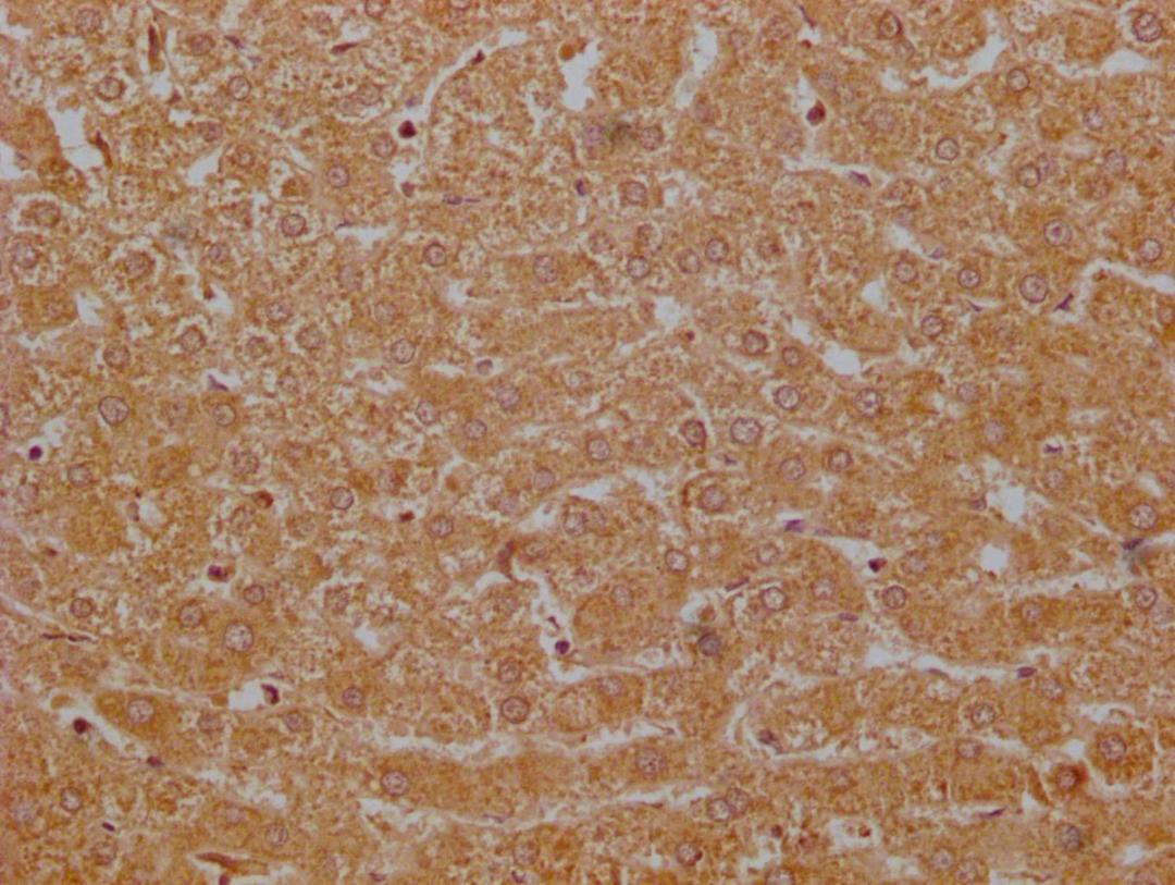 IHC image of CSB-PA009114EA01HU diluted at 1:200 and staining in paraffin-embedded human liver tissue performed on a Leica BondTM system. After dewaxing and hydration, antigen retrieval was mediated by high pressure in a citrate buffer (pH 6.0). Section was blocked with 10% normal goat serum 30min at RT. Then primary antibody (1% BSA) was incubated at 4°C overnight. The primary is detected by a Goat anti-rabbit polymer IgG labeled by HRP and visualized using 0.05% DAB.