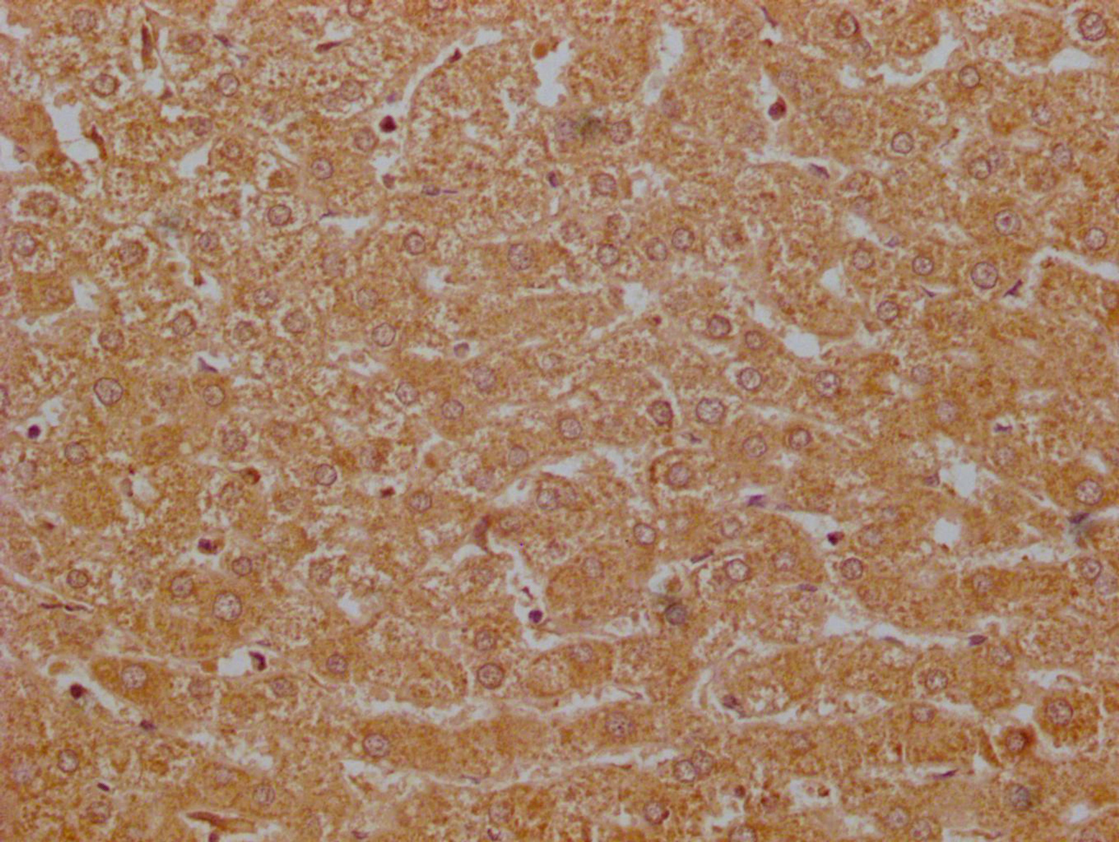 IHC image of CSB-PA009114EA01HU diluted at 1:200 and staining in paraffin-embedded human liver tissue performed on a Leica BondTM system. After dewaxing and hydration, antigen retrieval was mediated by high pressure in a citrate buffer (pH 6.0). Section was blocked with 10% normal goat serum 30min at RT. Then primary antibody (1% BSA) was incubated at 4°C overnight. The primary is detected by a Goat anti-rabbit polymer IgG labeled by HRP and visualized using 0.05% DAB.
