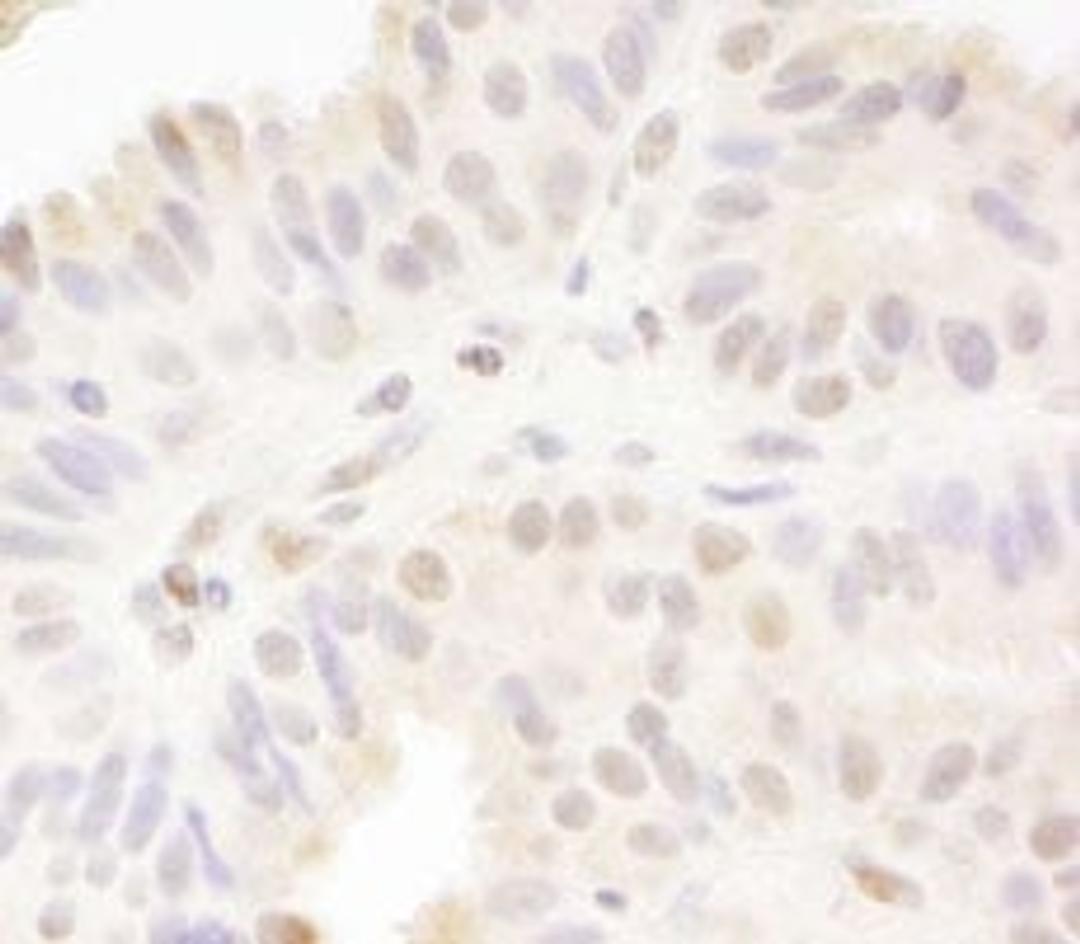 Detection of human MAML1 by immunohistochemistry.