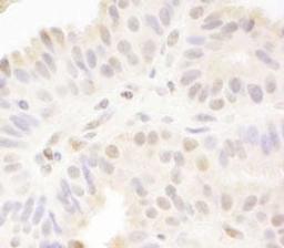 Detection of human MAML1 by immunohistochemistry.