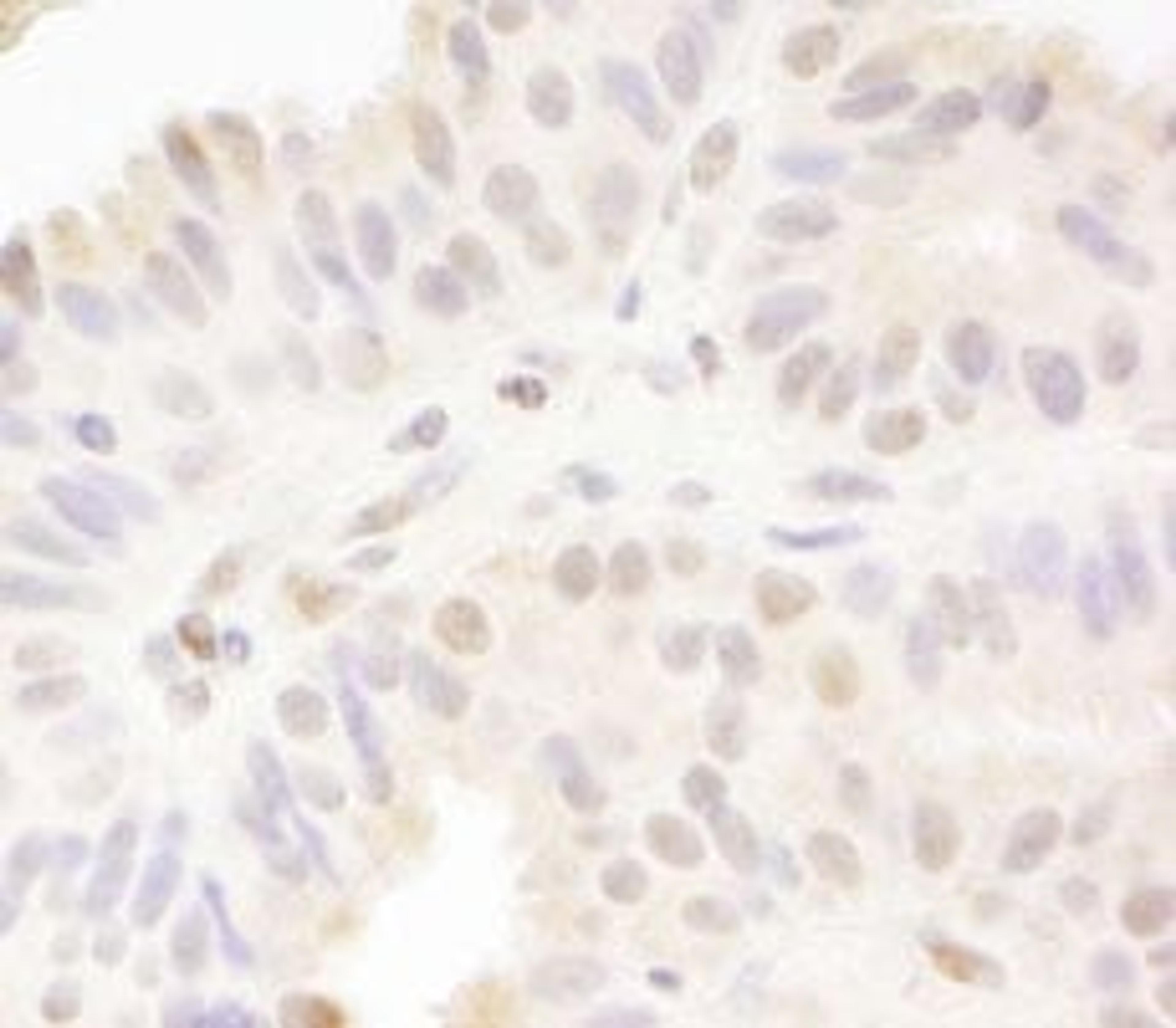 Detection of human MAML1 by immunohistochemistry.