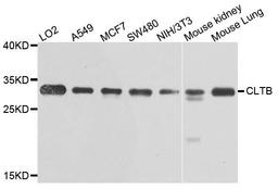 Western blot analysis of extracts of various cells using CLTB antibody