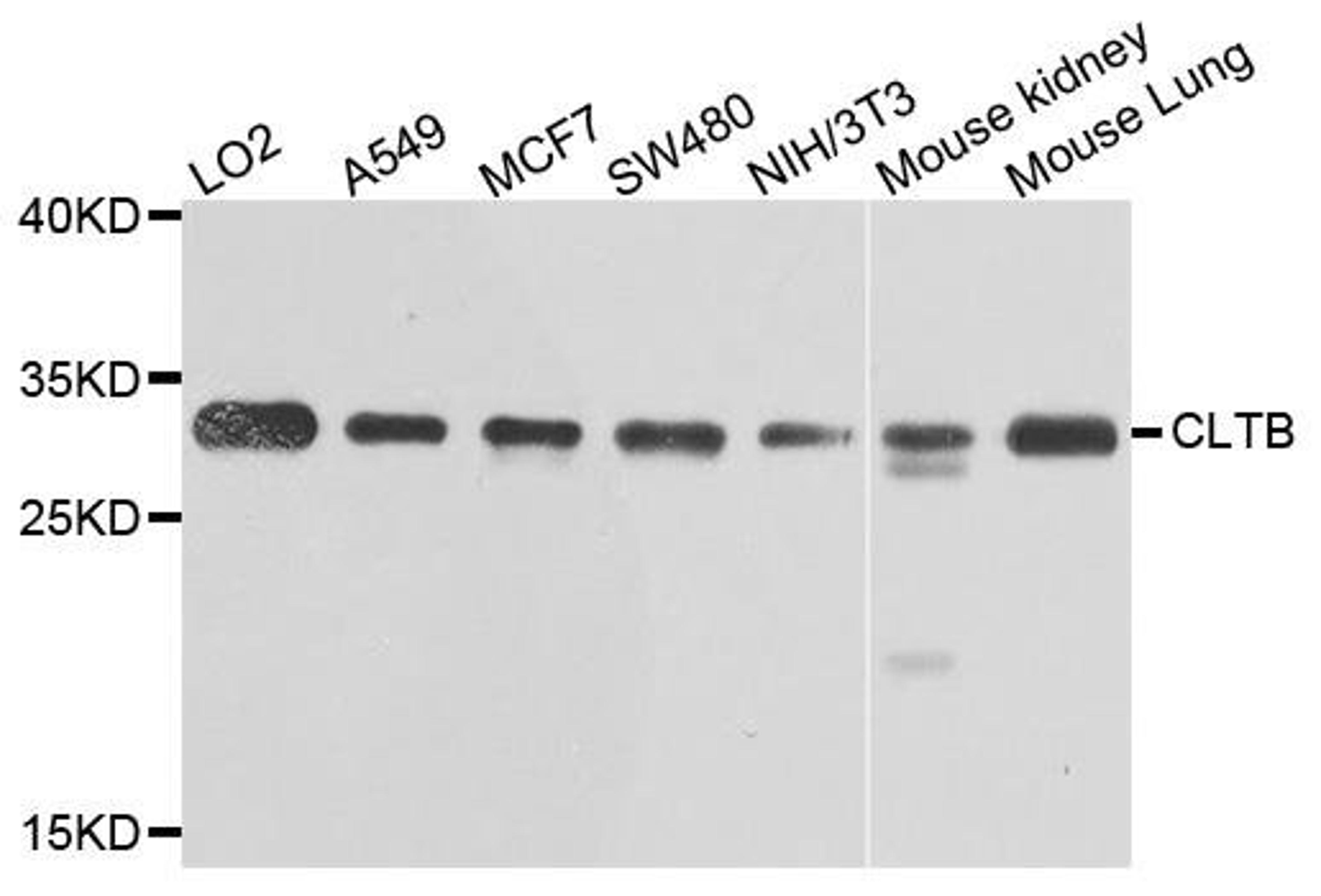 Western blot analysis of extracts of various cells using CLTB antibody