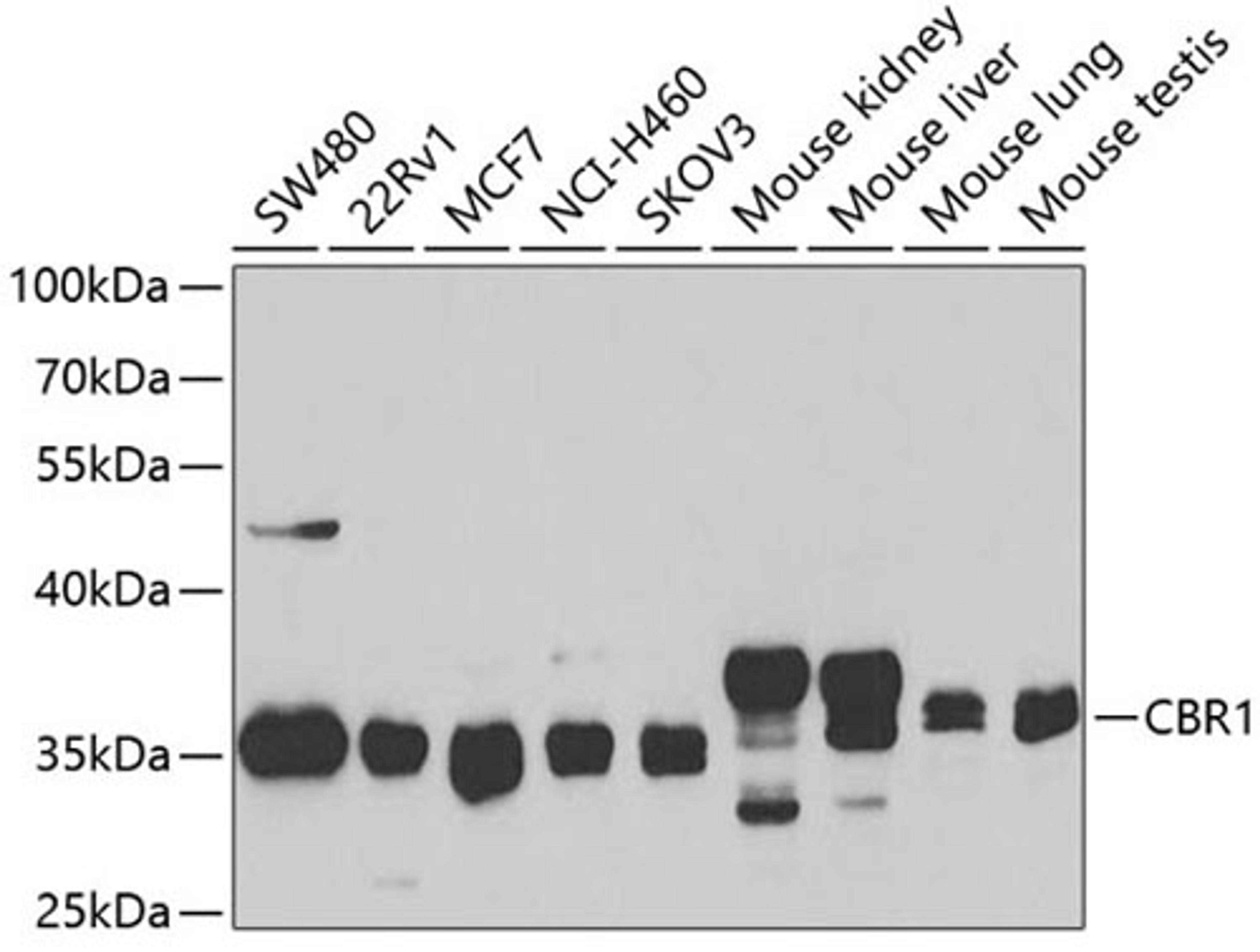 Western blot - CBR1 antibody (A5446)