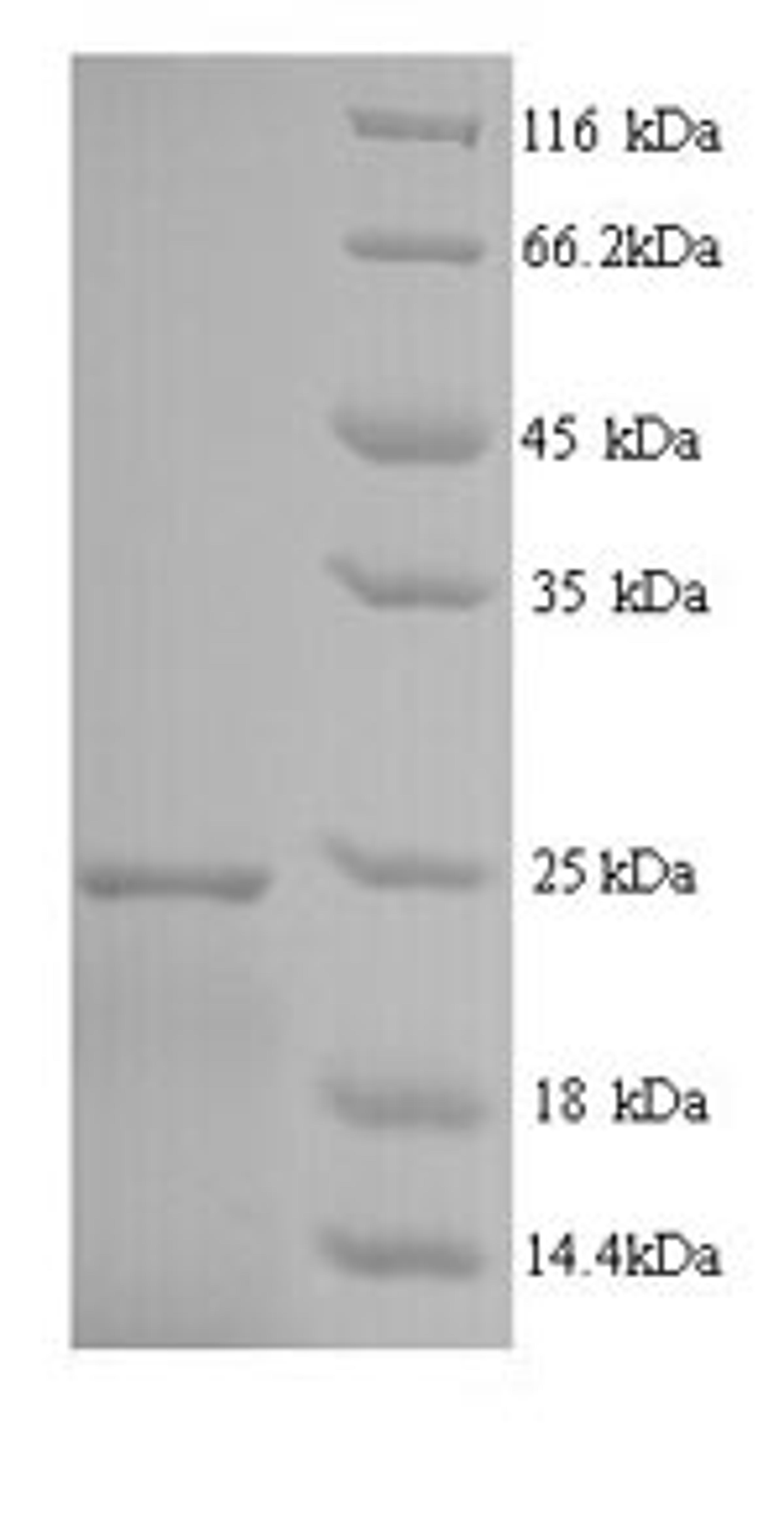 (Tris-Glycine gel) Discontinuous SDS-PAGE (reduced) with 5% enrichment gel and 15% separation gel.