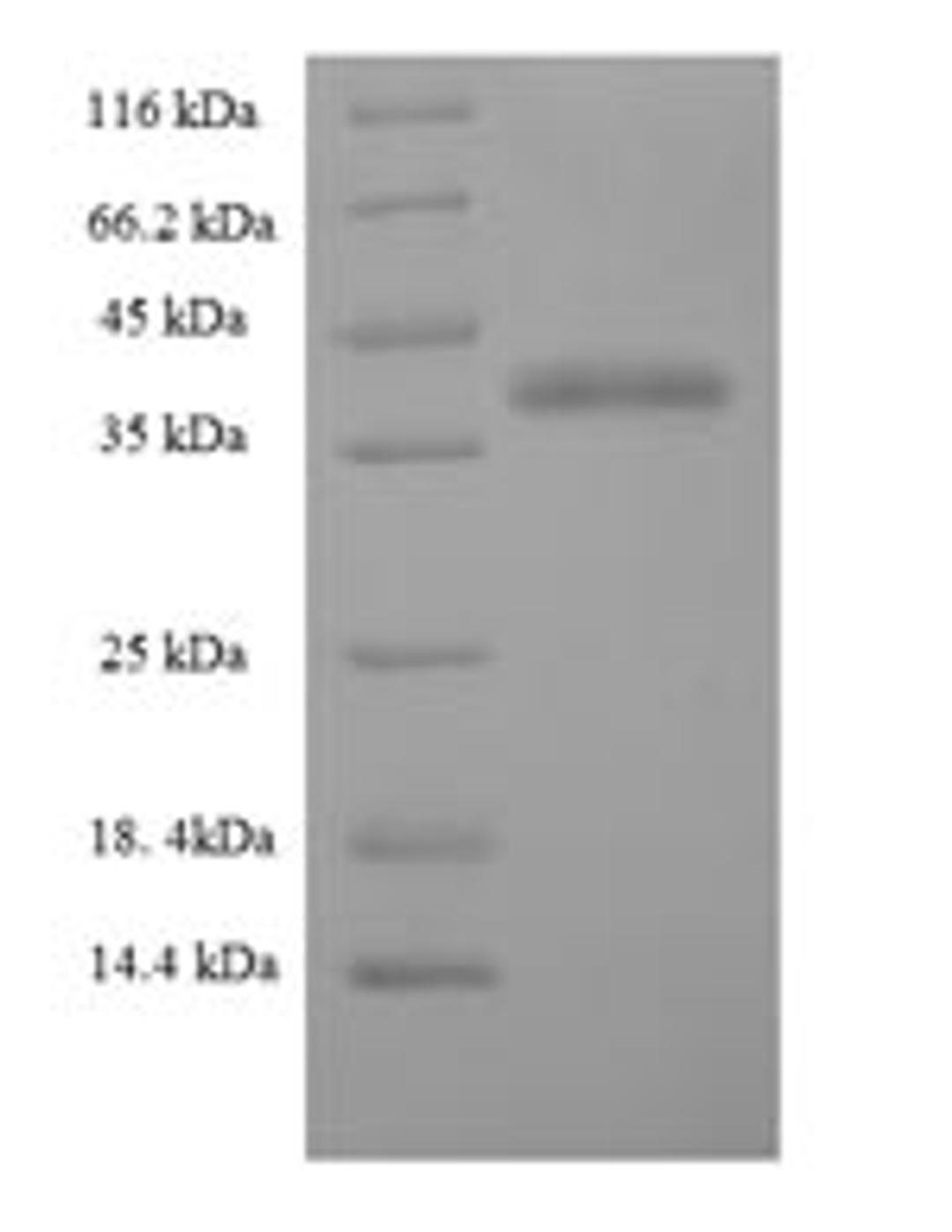 (Tris-Glycine gel) Discontinuous SDS-PAGE (reduced) with 5% enrichment gel and 15% separation gel.