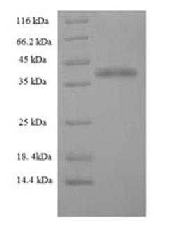 (Tris-Glycine gel) Discontinuous SDS-PAGE (reduced) with 5% enrichment gel and 15% separation gel.