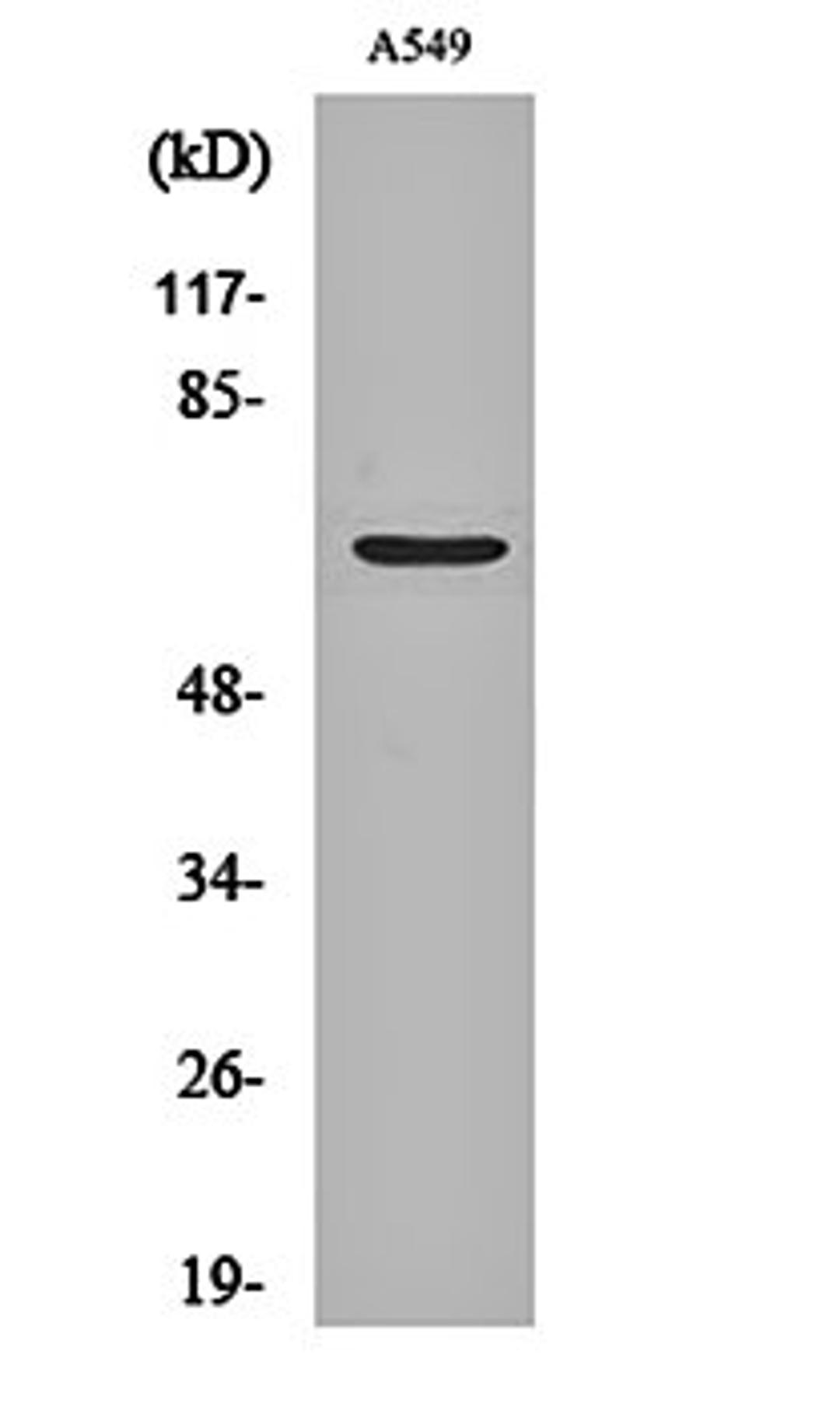 Western blot analysis of A549 cell lysates using Chr-A antibody