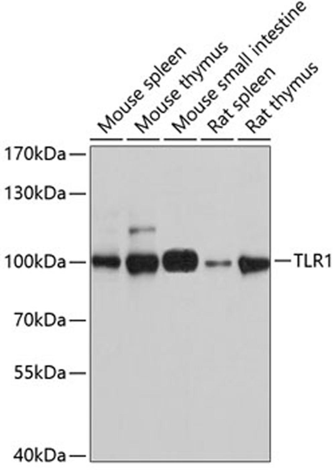 Western blot - TLR1 antibody (A0997)