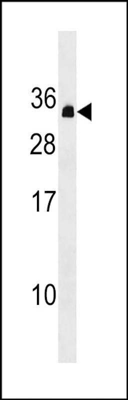 Western blot analysis in CEM cell line lysates (35ug/lane).