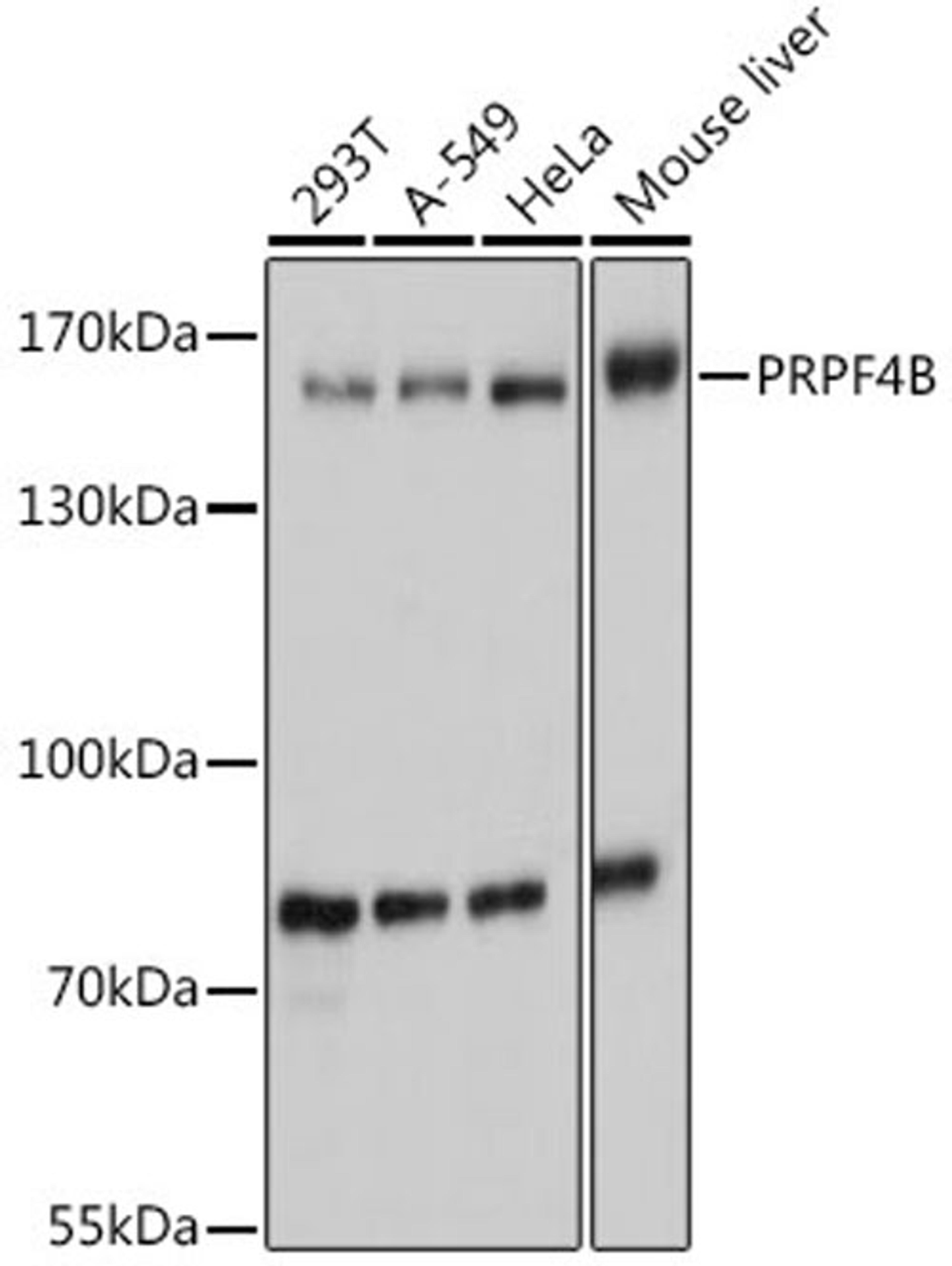 Western blot - PRPF4B antibody (A14815)