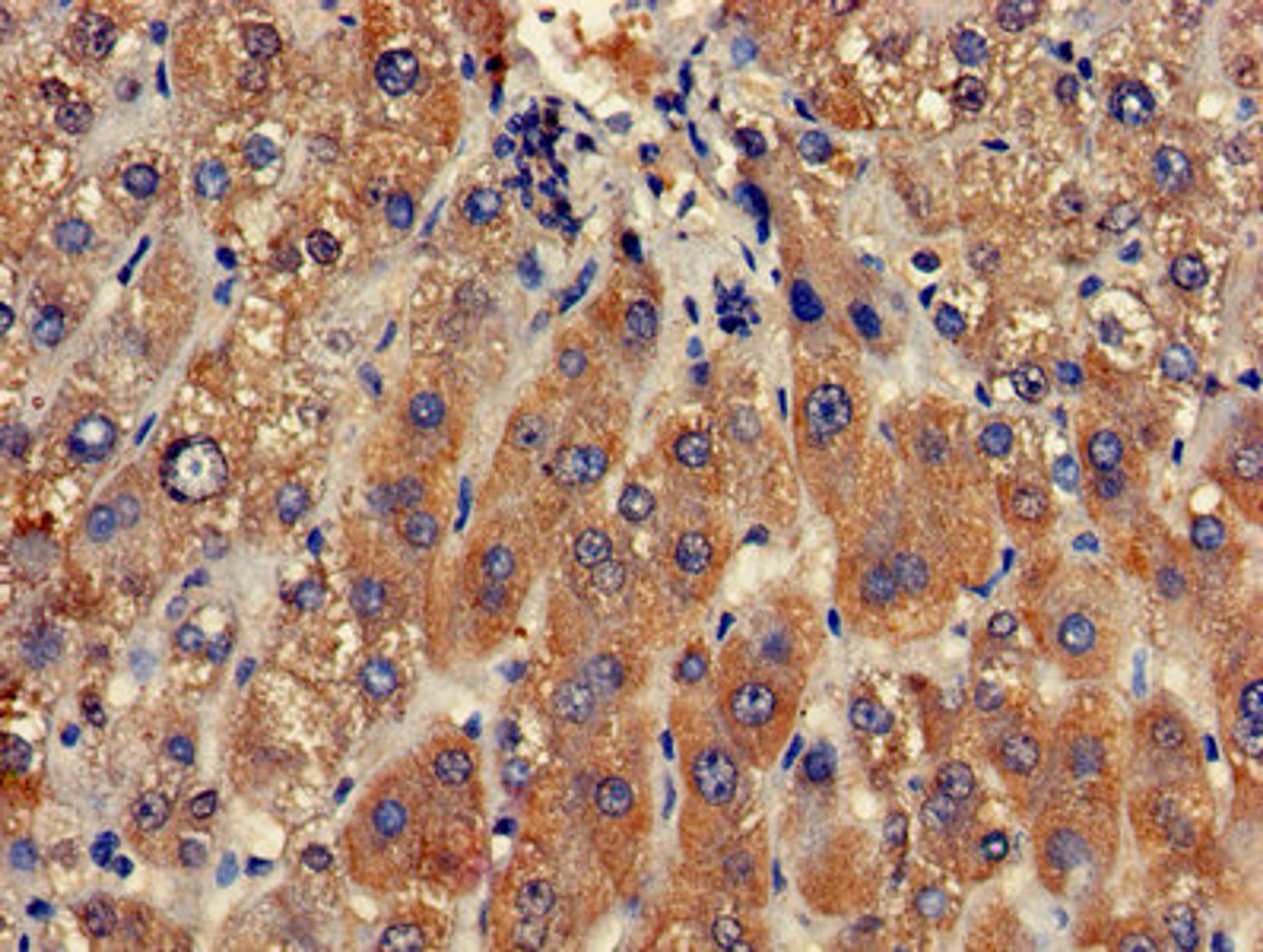 Immunohistochemistry of paraffin-embedded human liver tissue using CSB-PA005584LA01HU at dilution of 1:100