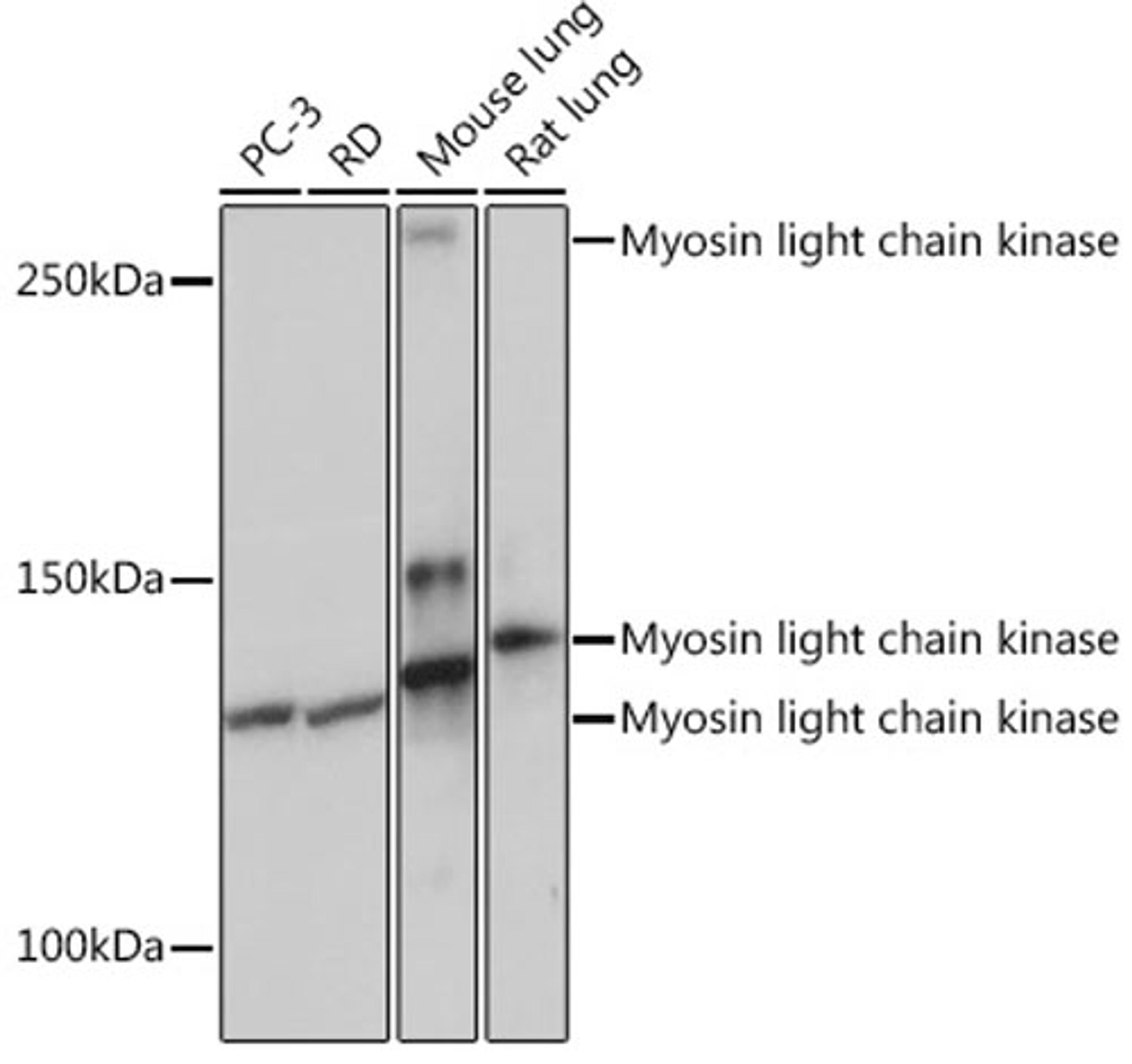 Western blot - Myosin light chain kinase Rabbit mAb (A3835)