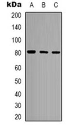 Western blot analysis of POLR3E expression in Hela (Lane 1), Jurkat (Lane 2), Ramos (Lane 3) whole cell lysates using POLR3E antibody