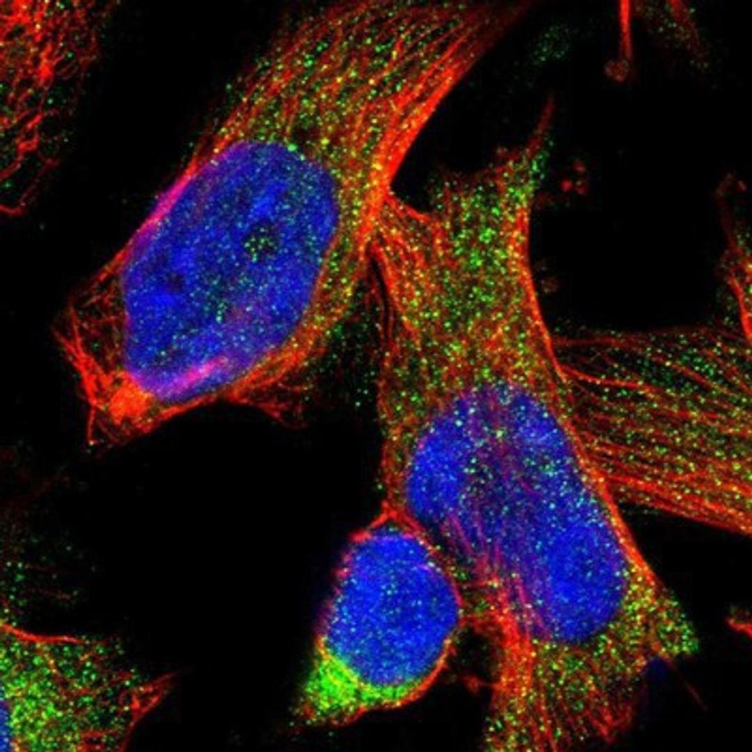 Immunocytochemistry/Immunofluorescence: CARD14 Antibody [NBP1-88598] Staining of human cell line U-251MG shows positivity in cytoplasm.