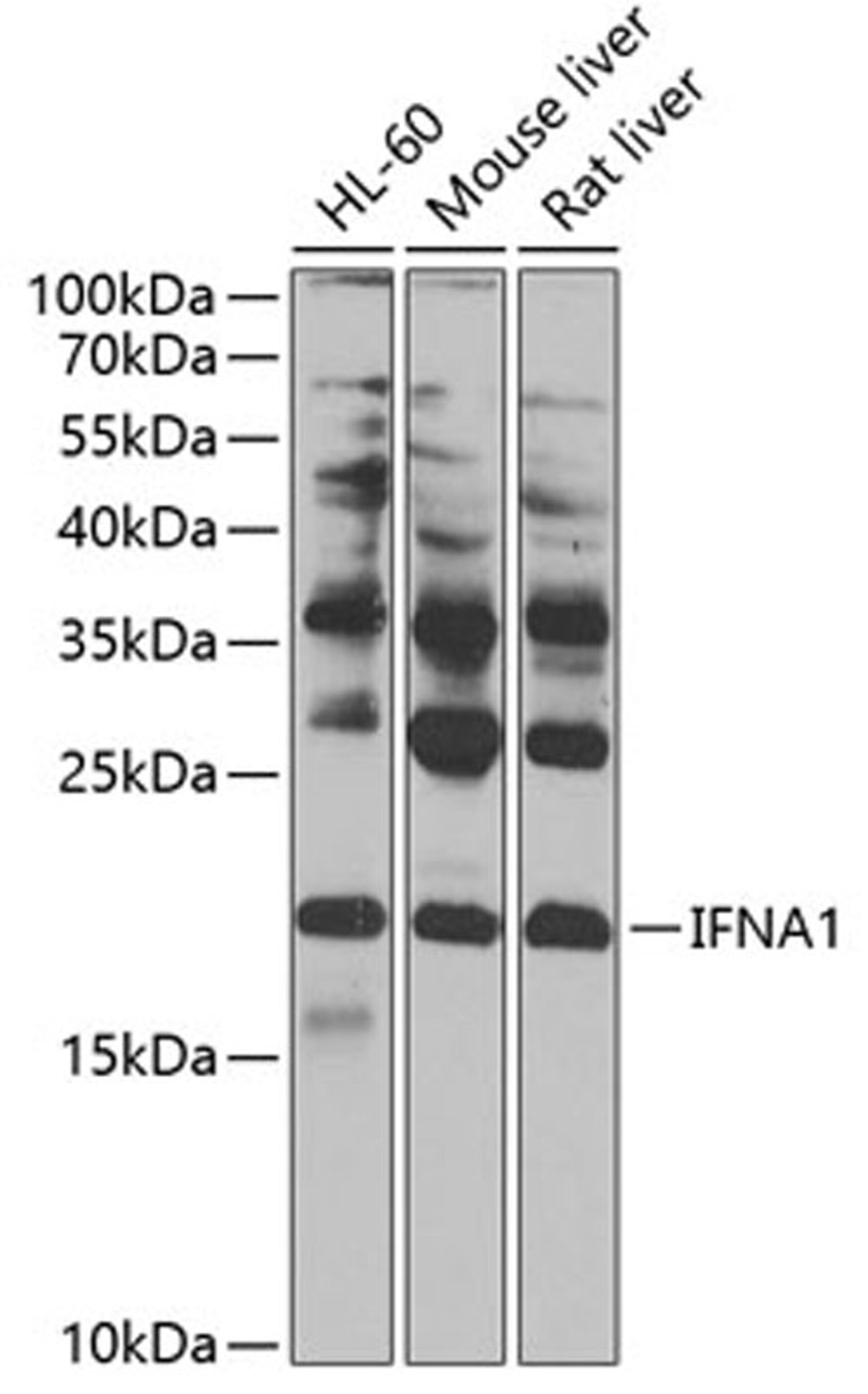 Western blot - IFNA1 antibody (A0285)