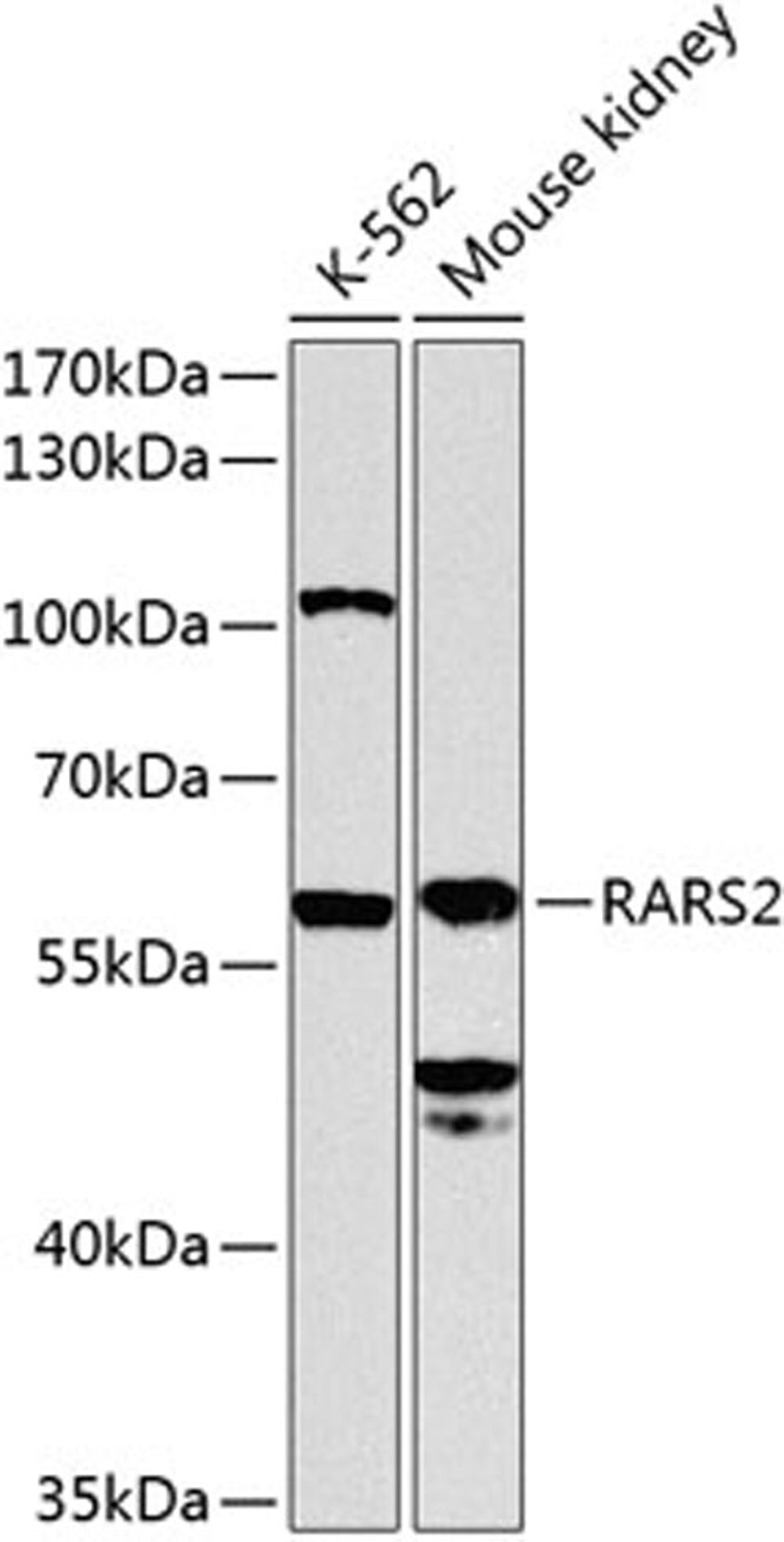 Western blot - RARS2 antibody (A8503)