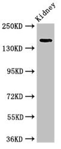 Western Blot. Positive WB detected in: Rat kidney tissue. All lanes: USP6 antibody at 4ug/ml. Secondary. Goat polyclonal to rabbit IgG at 1/50000 dilution. Predicted band size: 159, 122, 90 kDa. Observed band size: 159 kDa. 