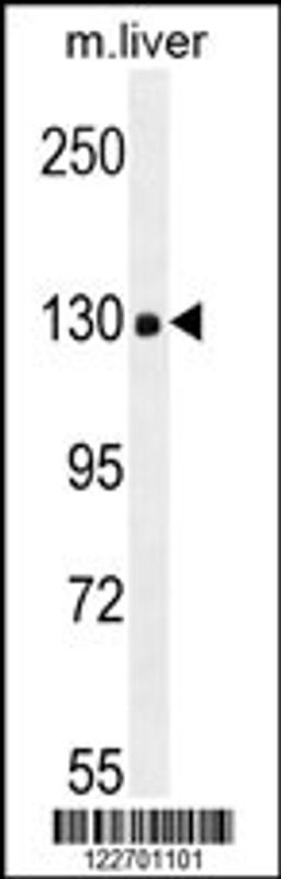 Western blot analysis in mouse liver tissue lysates (35ug/lane).