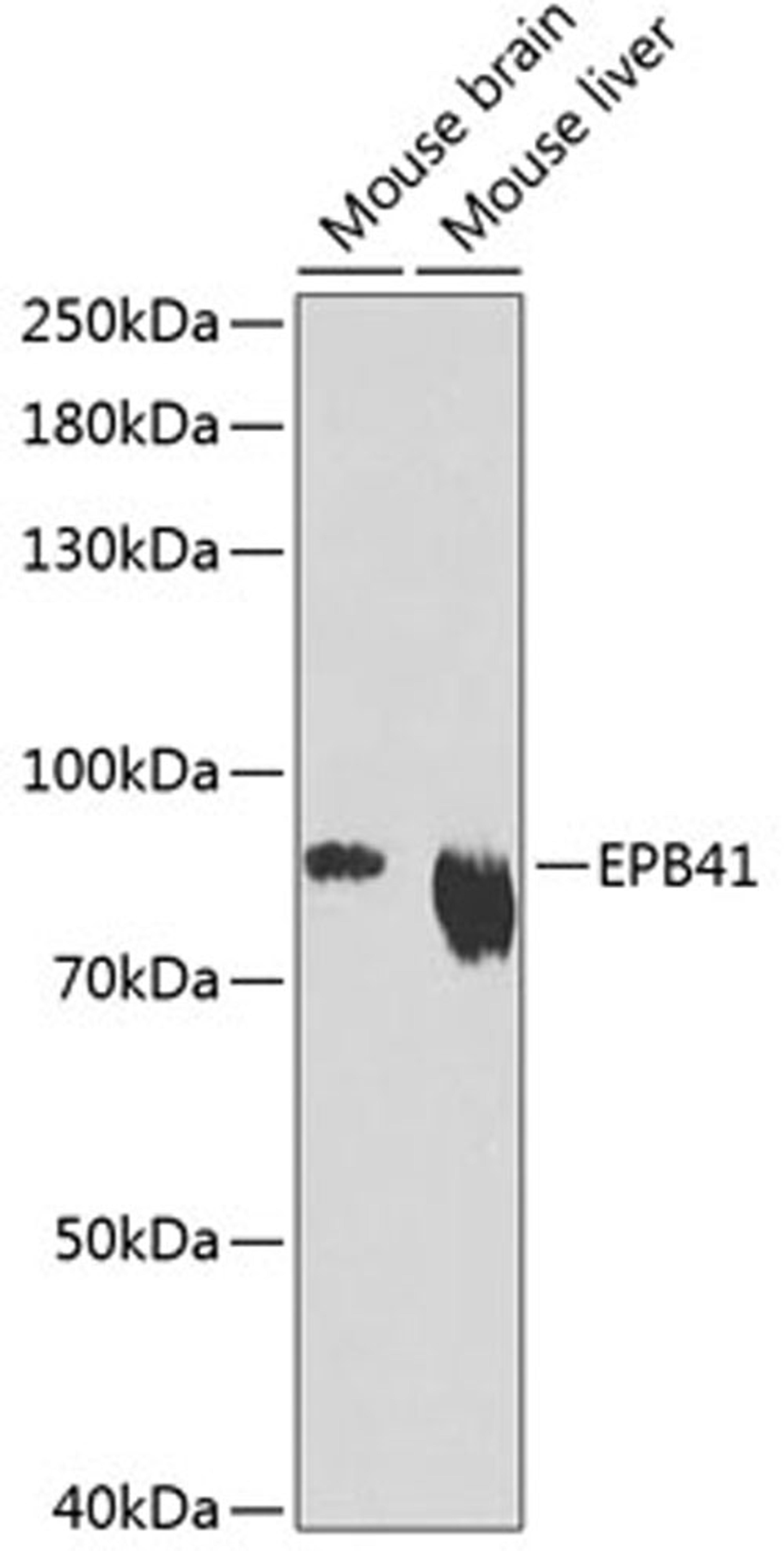 Western blot - EPB41 Antibody (A12434)