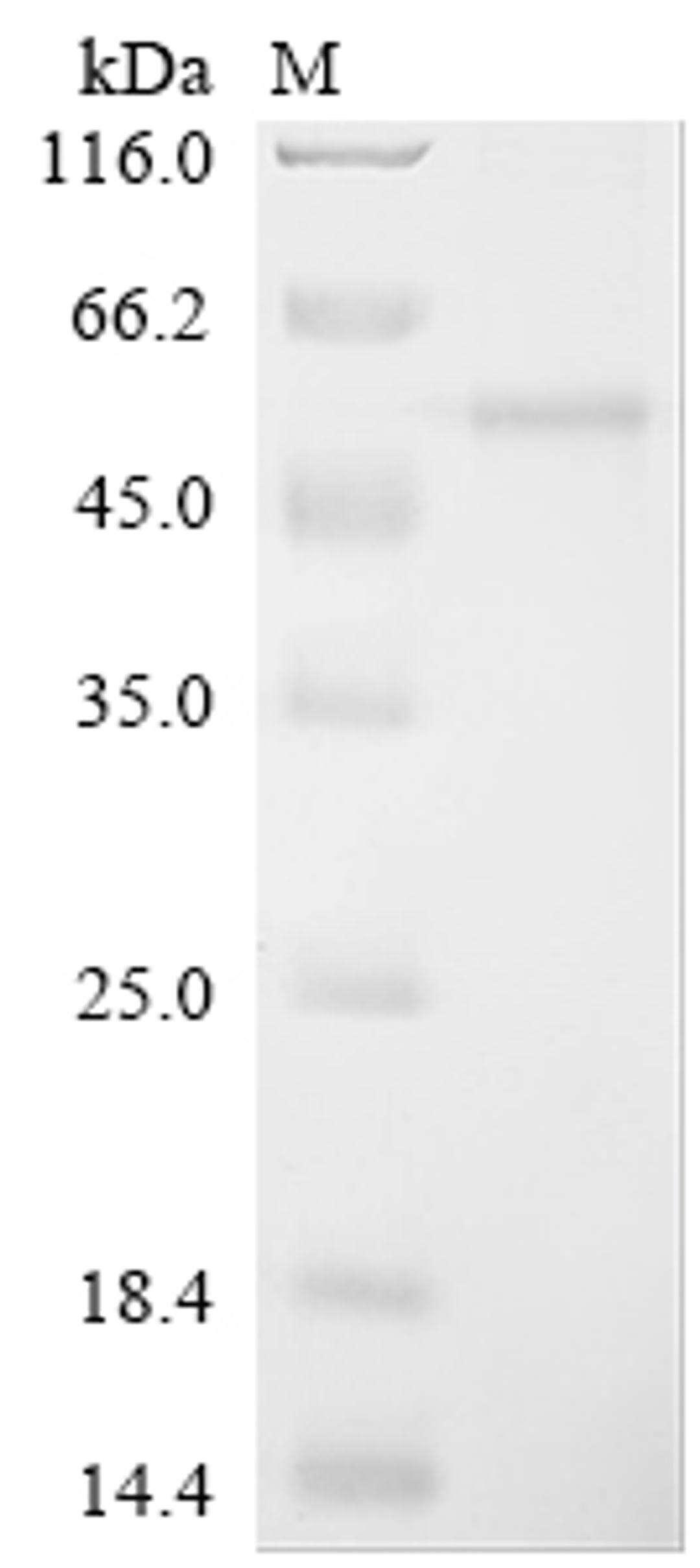 (Tris-Glycine gel) Discontinuous SDS-PAGE (reduced) with 5% enrichment gel and 15% separation gel.