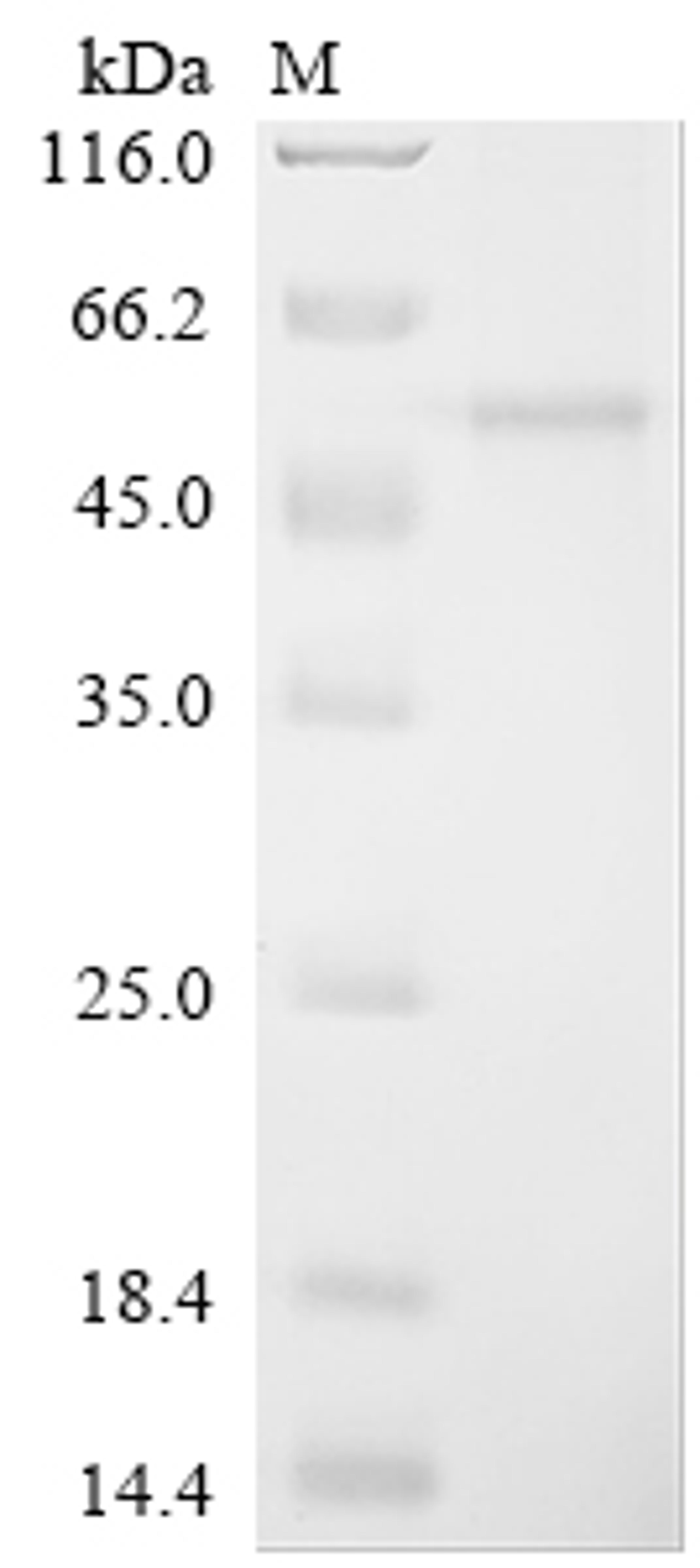 (Tris-Glycine gel) Discontinuous SDS-PAGE (reduced) with 5% enrichment gel and 15% separation gel.