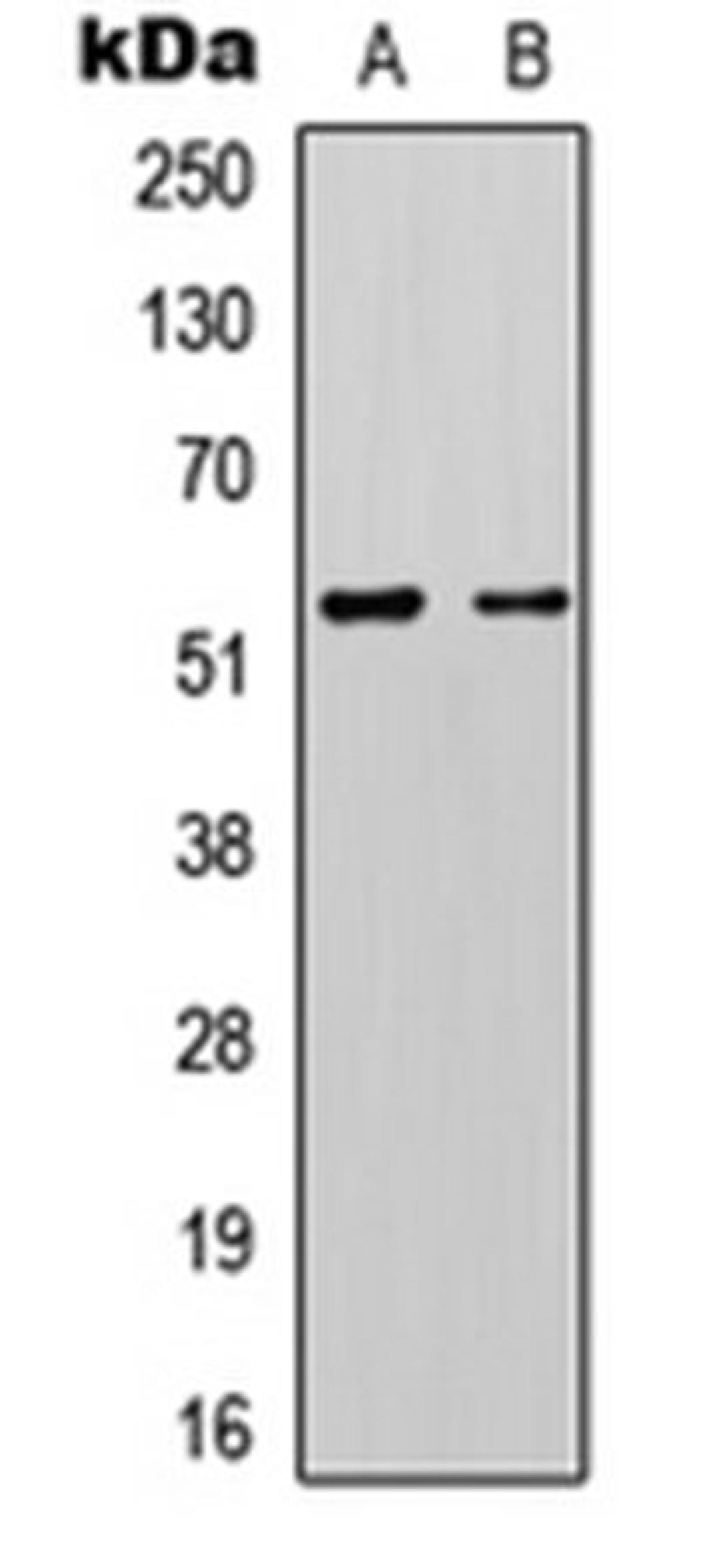 Western blot analysis of Jurkat (Lane 1), mouse brain (Lane 2) whole cell lysates using KCNK3 antibody