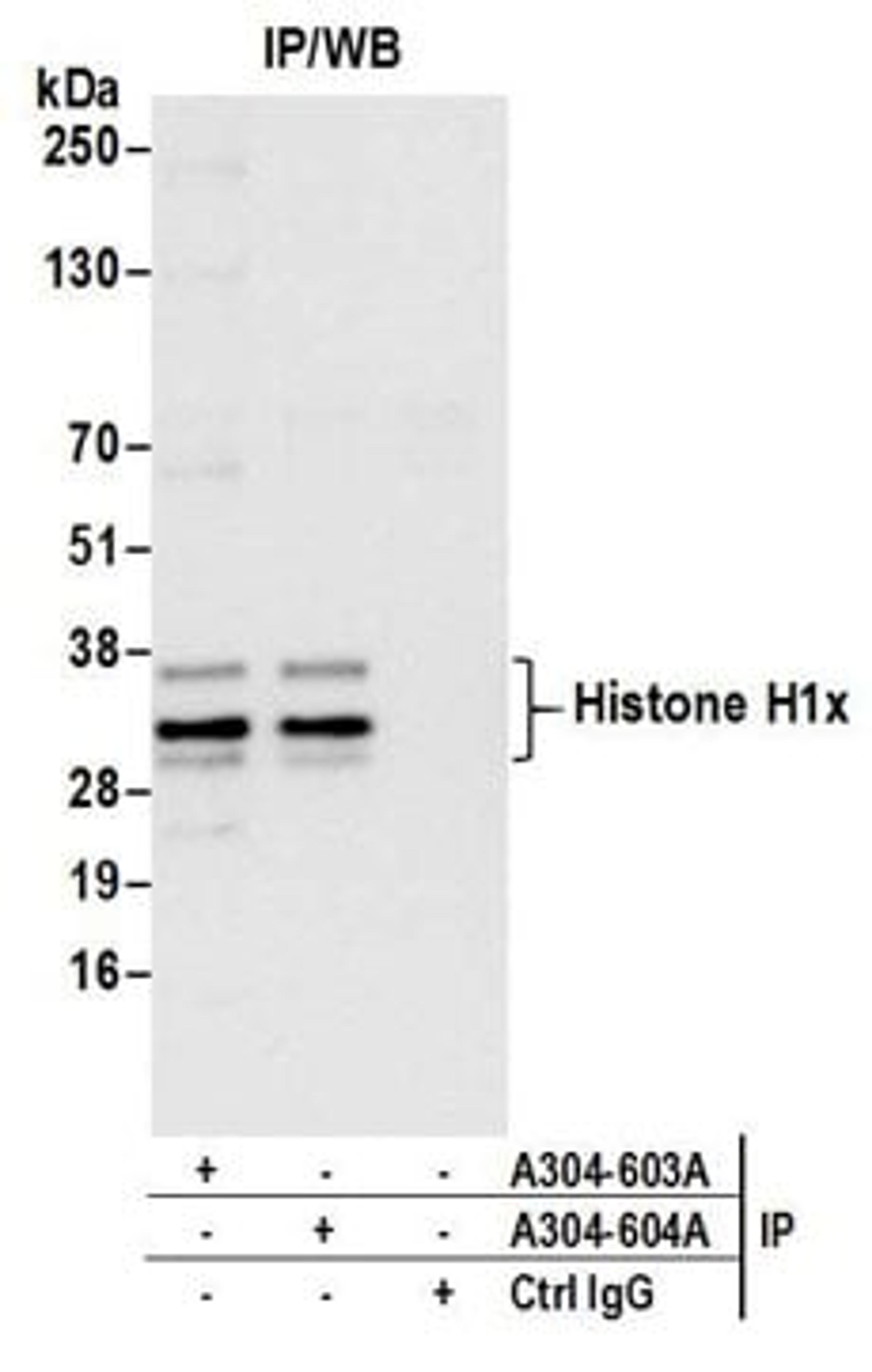 Detection of human Histone H1x by western blot of immunoprecipitates.