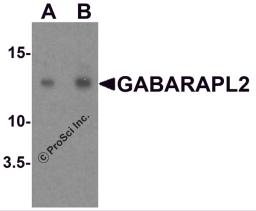 Western blot analysis of GABARAPL2 in human brain tissue lysate with GABARAPL2 antibody at (A) 1 and (B) 2 &#956;g/ml.