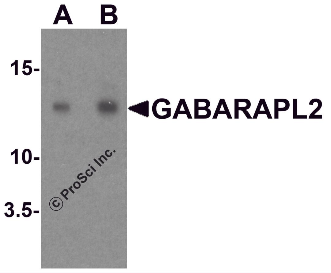 Western blot analysis of GABARAPL2 in human brain tissue lysate with GABARAPL2 antibody at (A) 1 and (B) 2 μg/ml.