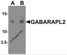 Western blot analysis of GABARAPL2 in human brain tissue lysate with GABARAPL2 antibody at (A) 1 and (B) 2 μg/ml.