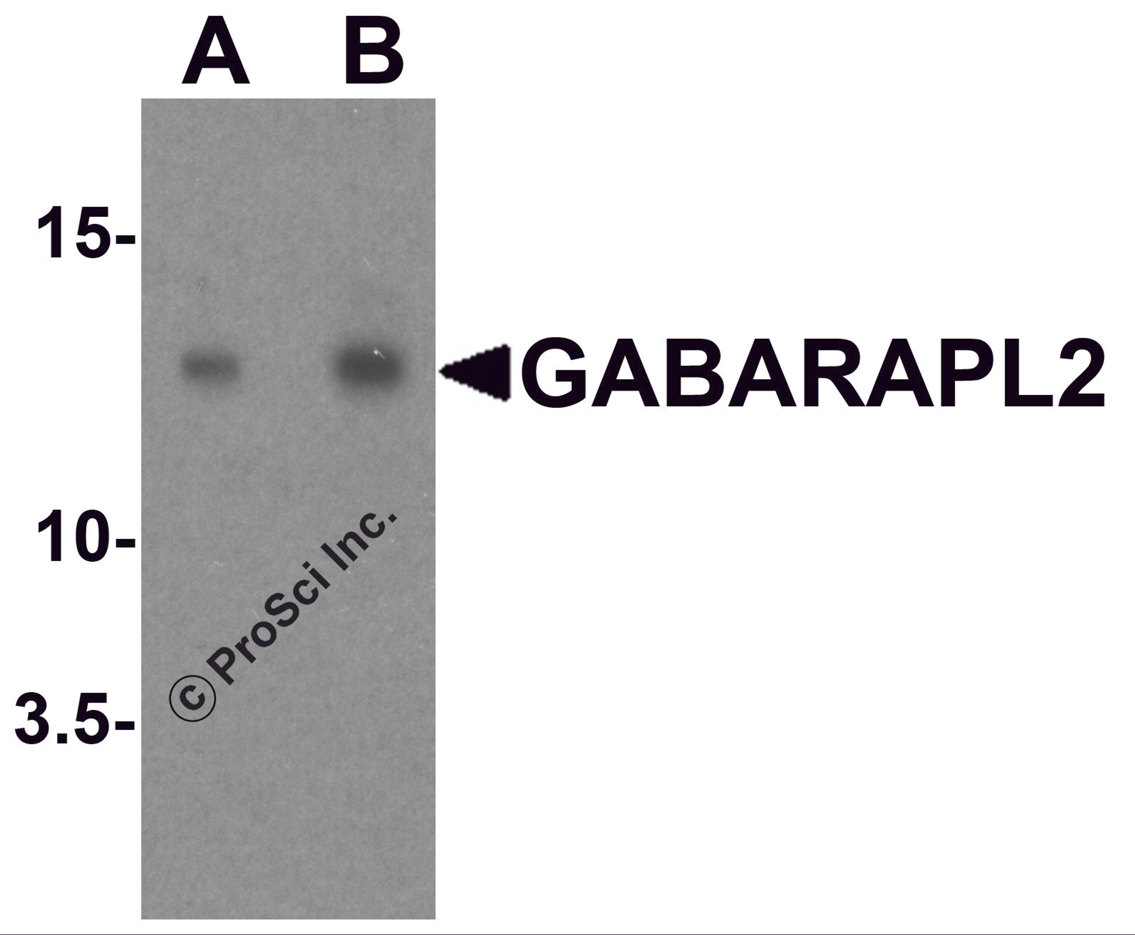 Western blot analysis of GABARAPL2 in human brain tissue lysate with GABARAPL2 antibody at (A) 1 and (B) 2 μg/ml.