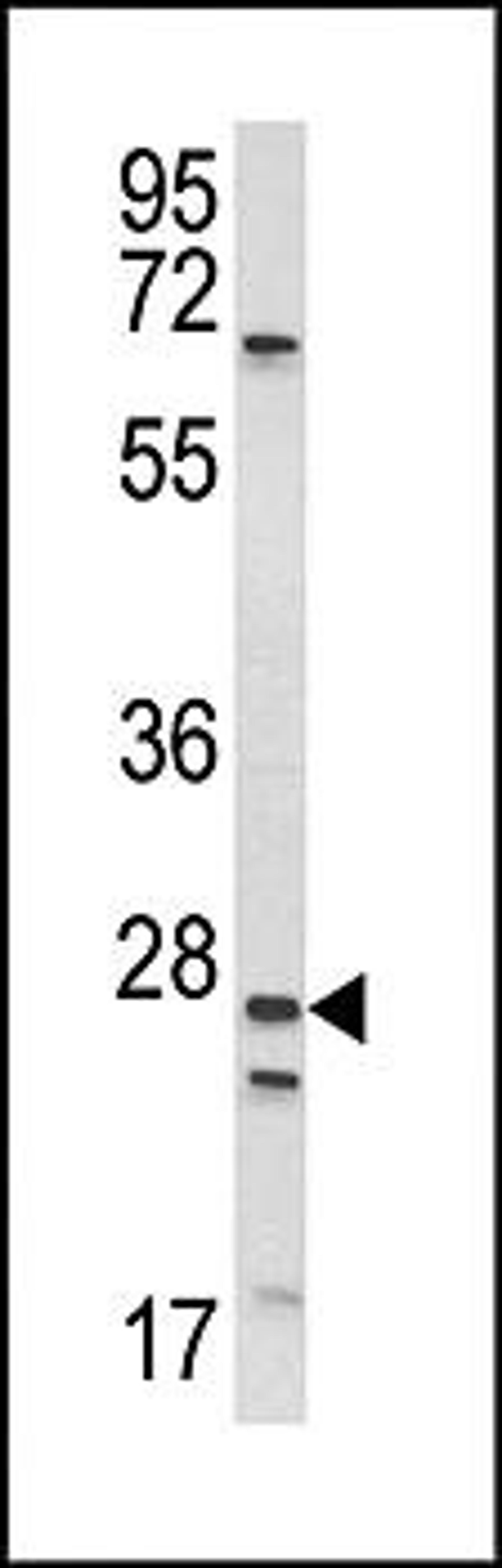 Western blot analysis of WiDr cell line lysates (35ug/lane) using ENaC Alpha antibody