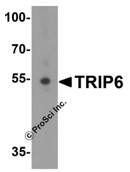 Western blot analysis of TRIP6 in A431 cell lysate with TRIP6 antibody at 1 μg/mL.