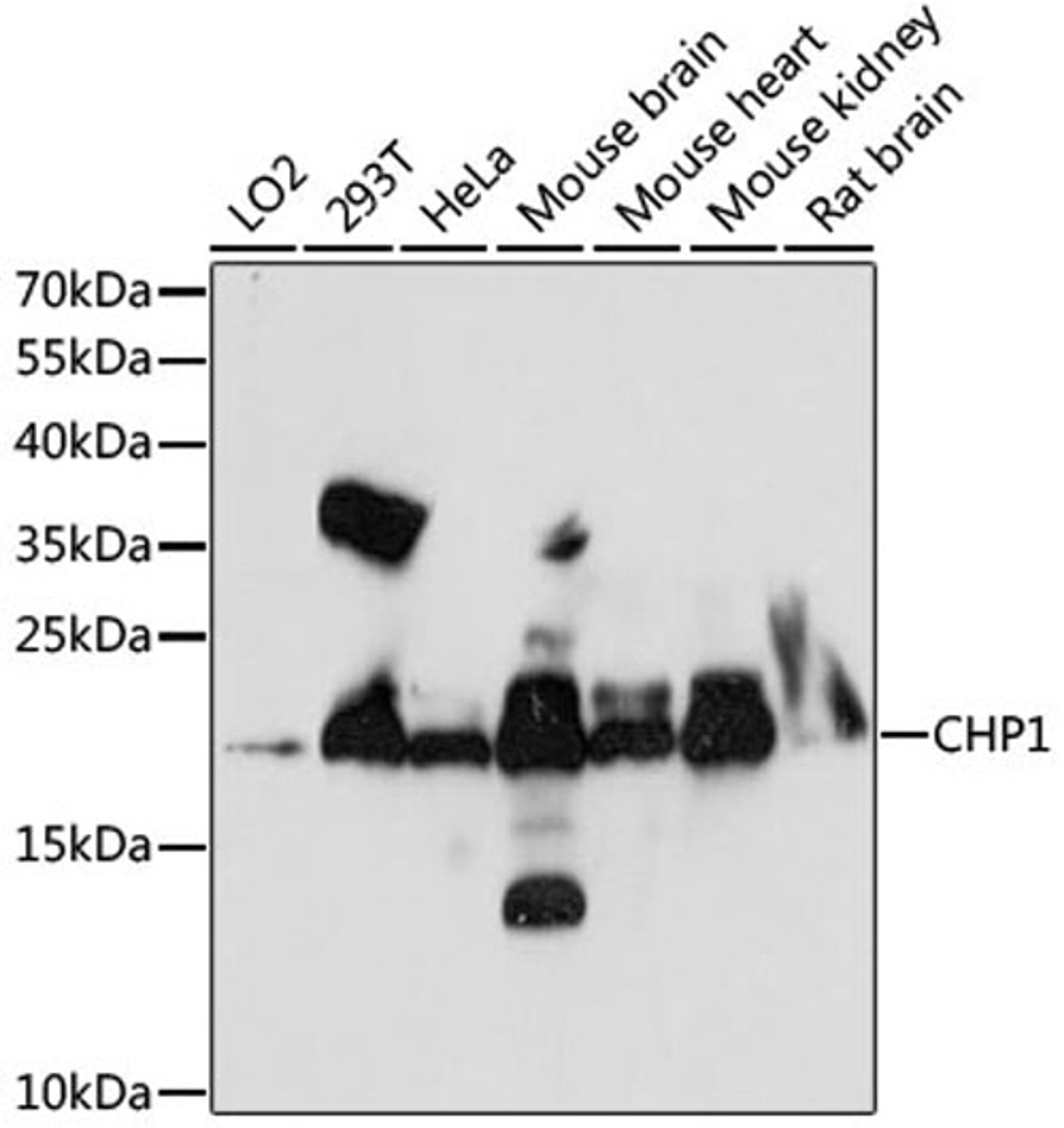 Western blot - CHP1 antibody (A15791)