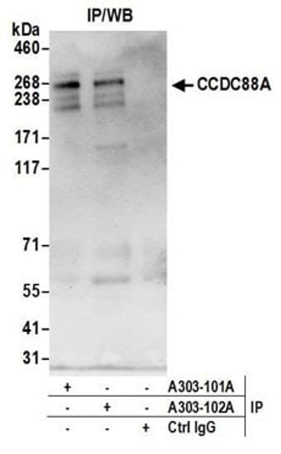 Detection of human CCDC88A by western blot of immunoprecipitates.