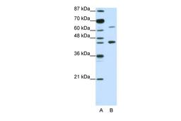 Antibody used in WB on Human Jurkat 1.25 ug/ml.