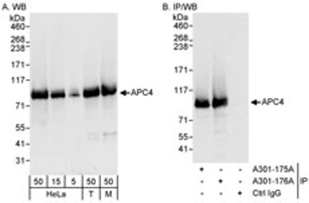 Detection of human and mouse APC4 by western blot (h&m) and immunoprecipitation (h).