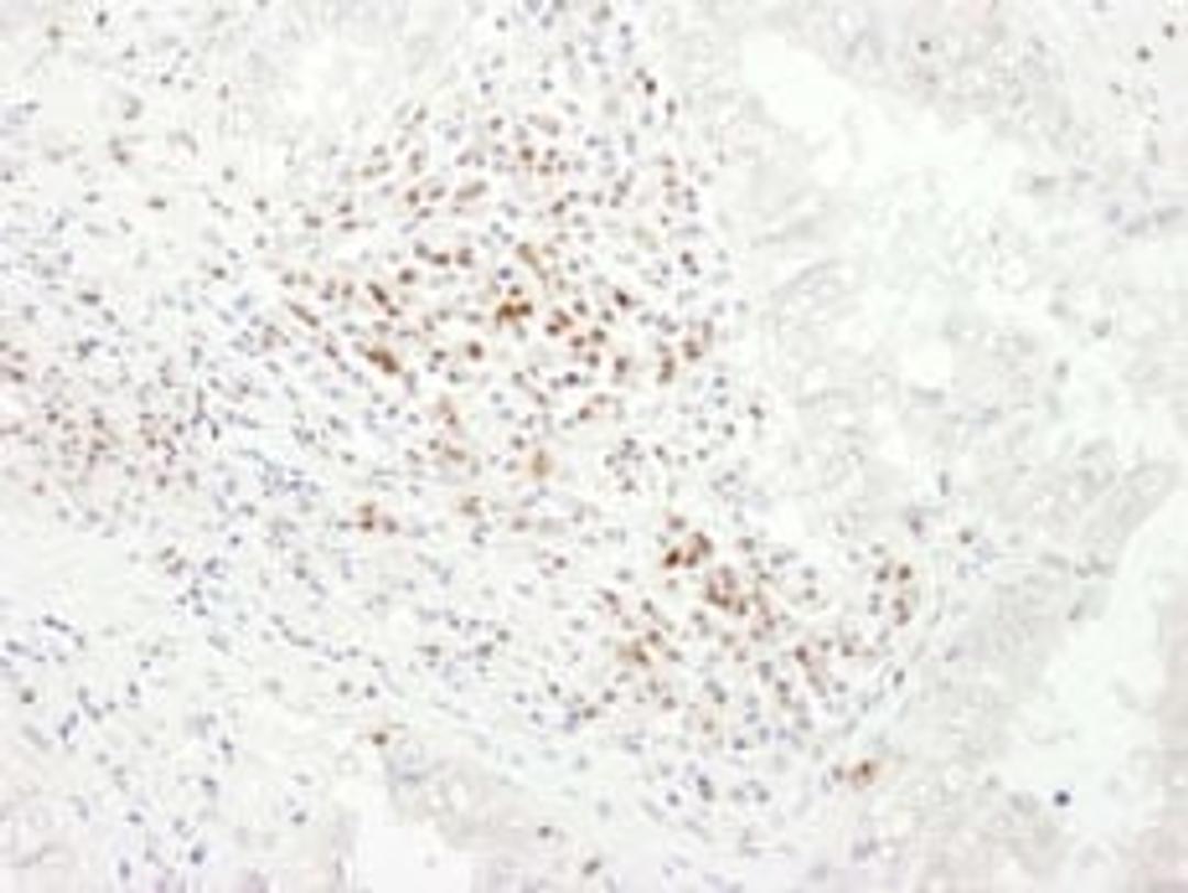 Detection of human CD3E by immunohistochemistry.