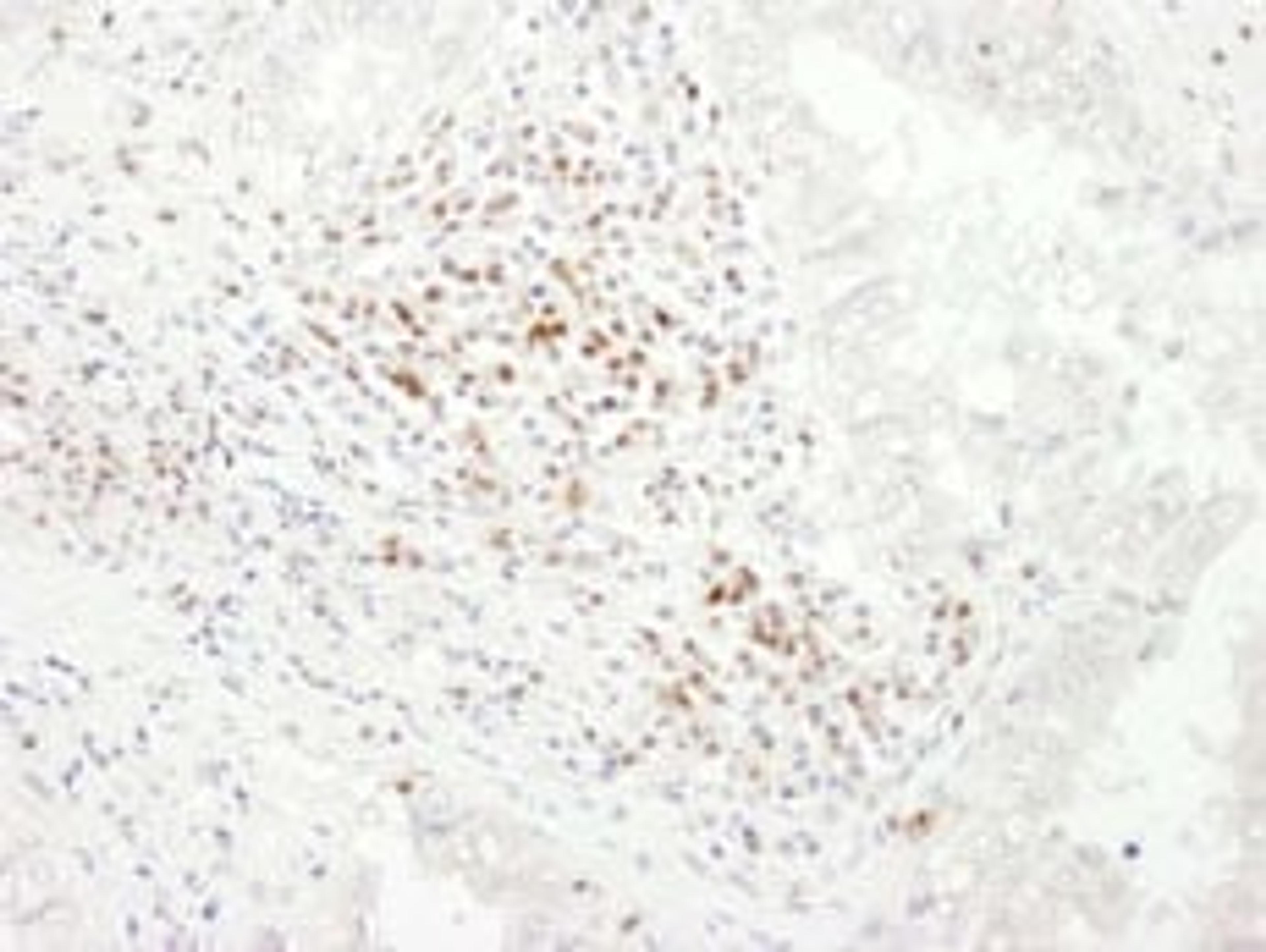 Detection of human CD3E by immunohistochemistry.