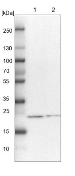 Western Blot: HSPC111 Antibody [NBP1-89659] - Lane 1: NIH-3T3 cell lysate (Mouse embryonic fibroblast cells)<br/>Lane 2: NBT-II cell lysate (Rat Wistar bladder tumour cells)