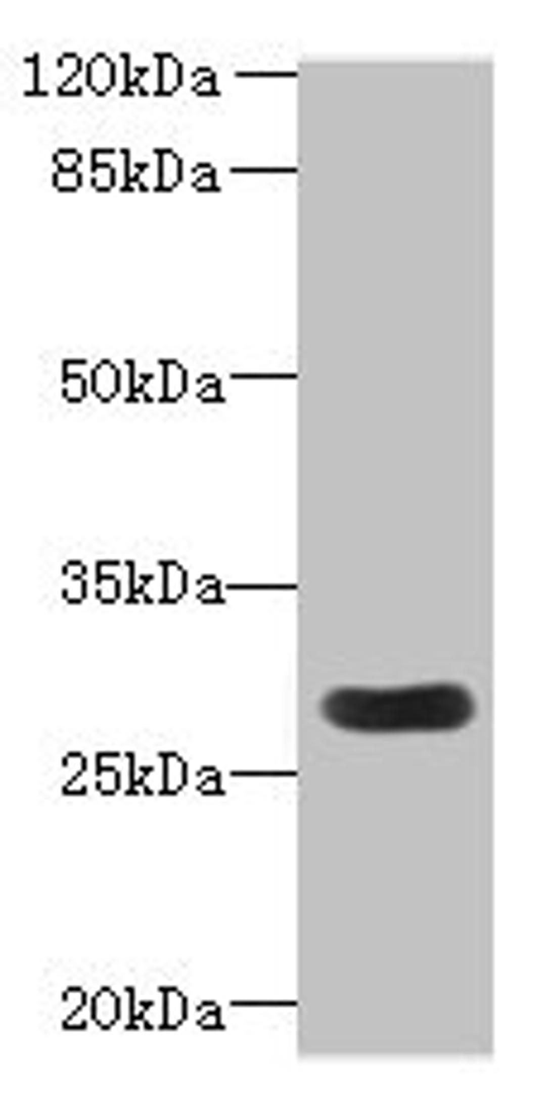 Western blot. All lanes: MORN3 antibody at 2µg/ml + Mouse kidney tissue. Secondary. Goat polyclonal to rabbit IgG at 1/10000 dilution. Predicted band size: 28, 19 kDa. Observed band size: 28 kDa
