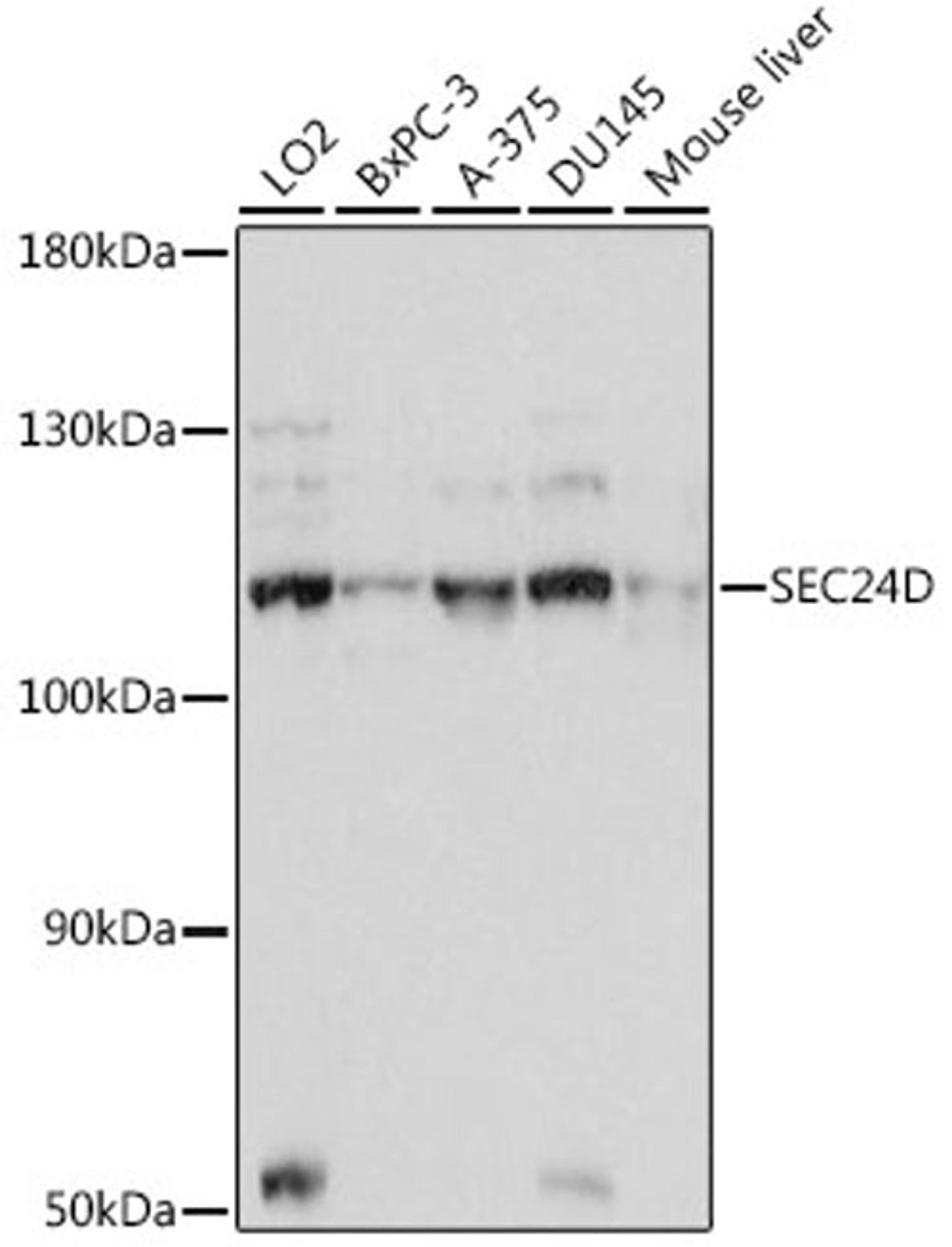 Western blot - SEC24D antibody (A16091)