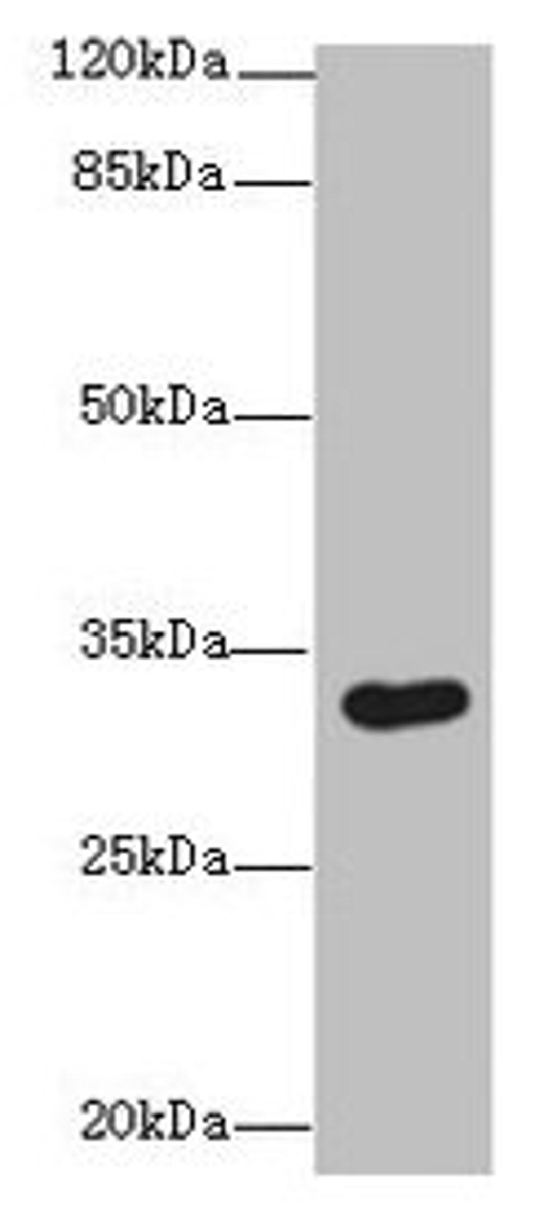 Western blot. All lanes: ASB8 antibody at 1µg/ml + Human placenta tissue. Secondary. Goat polyclonal to rabbit IgG at 1/10000 dilution. Predicted band size: 32 kDa. Observed band size: 32 kDa