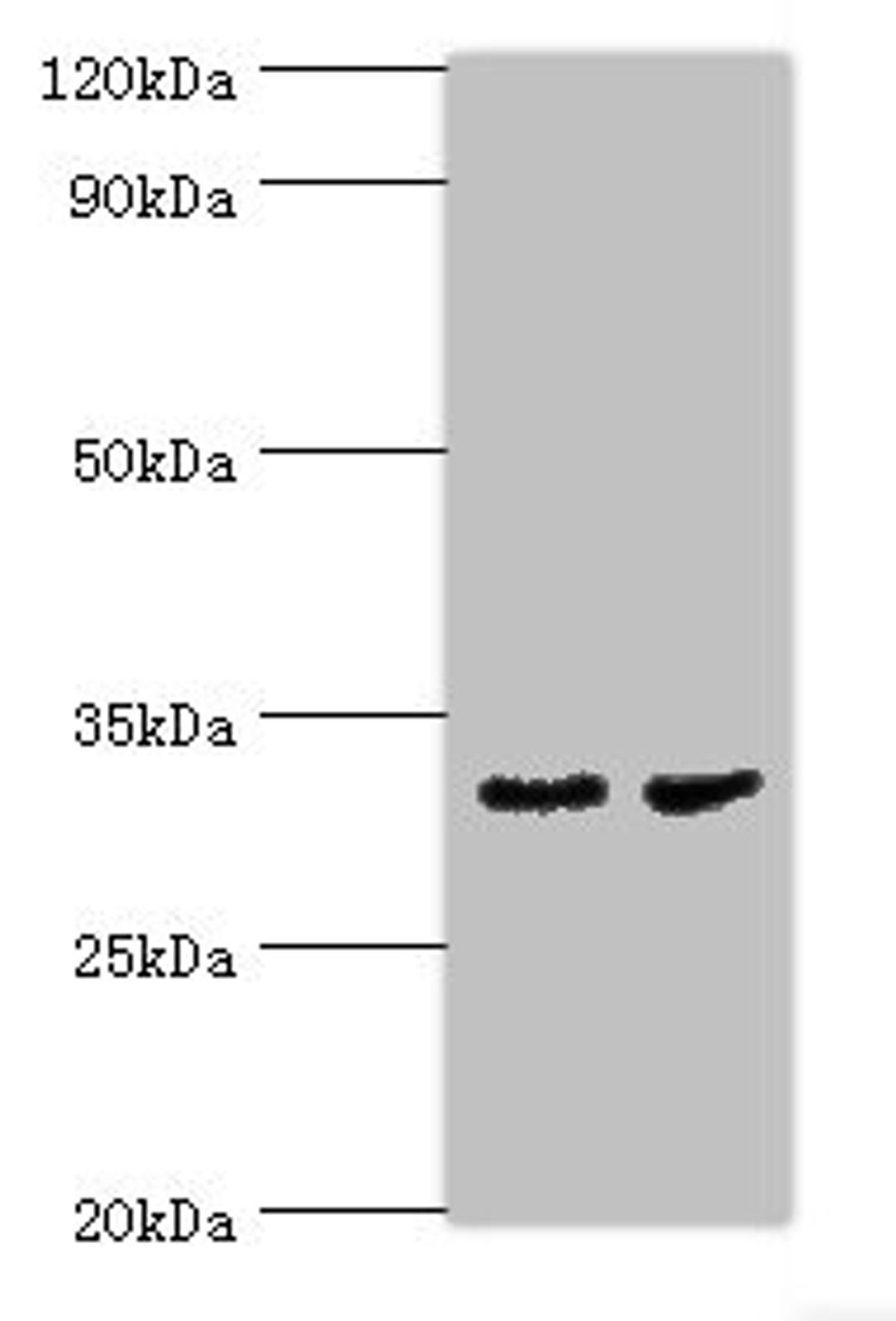 Western blot. All lanes: CA8 antibody at 4ug/ml. Lane 1: Mouse skeletal muscle tissue. Lane 2: Mouse liver tissue. Secondary. Goat polyclonal to rabbit IgG at 1/10000 dilution. Predicted band size: 33 kDa. Observed band size 33 kDa. 