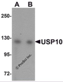 Western blot analysis of USP10 in Jurkat cell lysate with USP10 antibody at (A) 1 and (B) 2 &#956;g/mL.